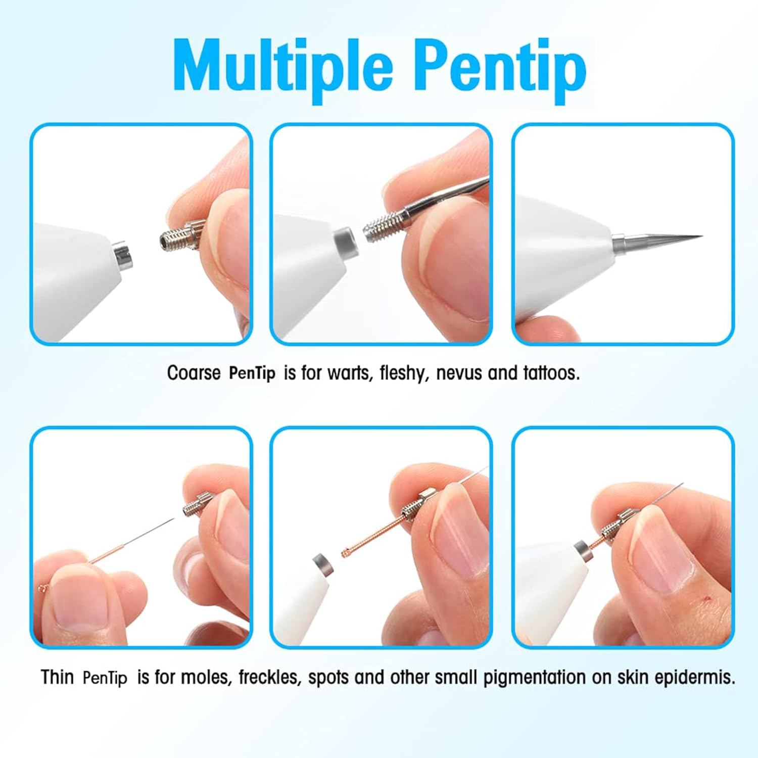 LARALA Skin Tag Remover Kit Plasma Pen for Face & Body, Fast and Easy Removal Pen for Warts, Nevus, Spot, Freckle, Tattoo image number 2