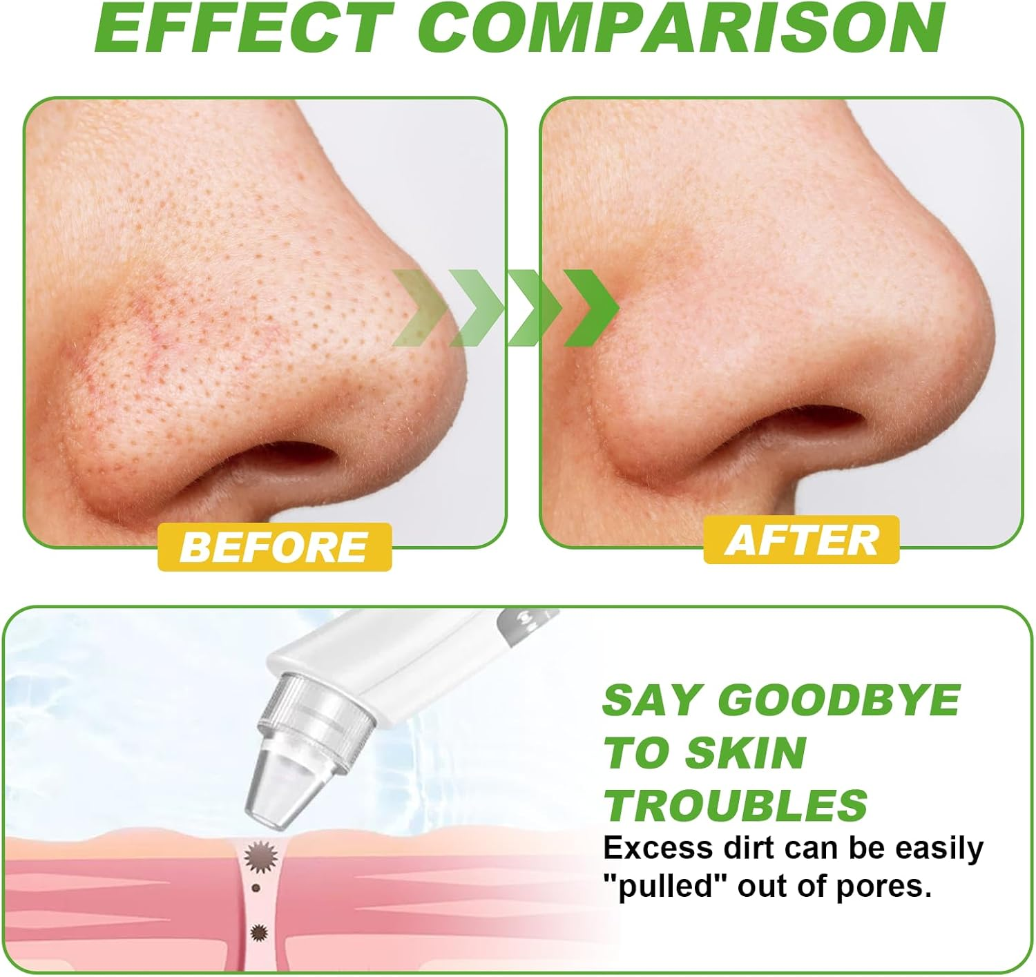 Visual Blackhead Remover Pore Vacuum, Blackhead Extractor with 5 Detachable Probes, USB Rechargeable Facial Pore Cleaner Kit for Deep Cleansing Acne Treatment on Nose & Face, Men & Women Beauty Device image number 3