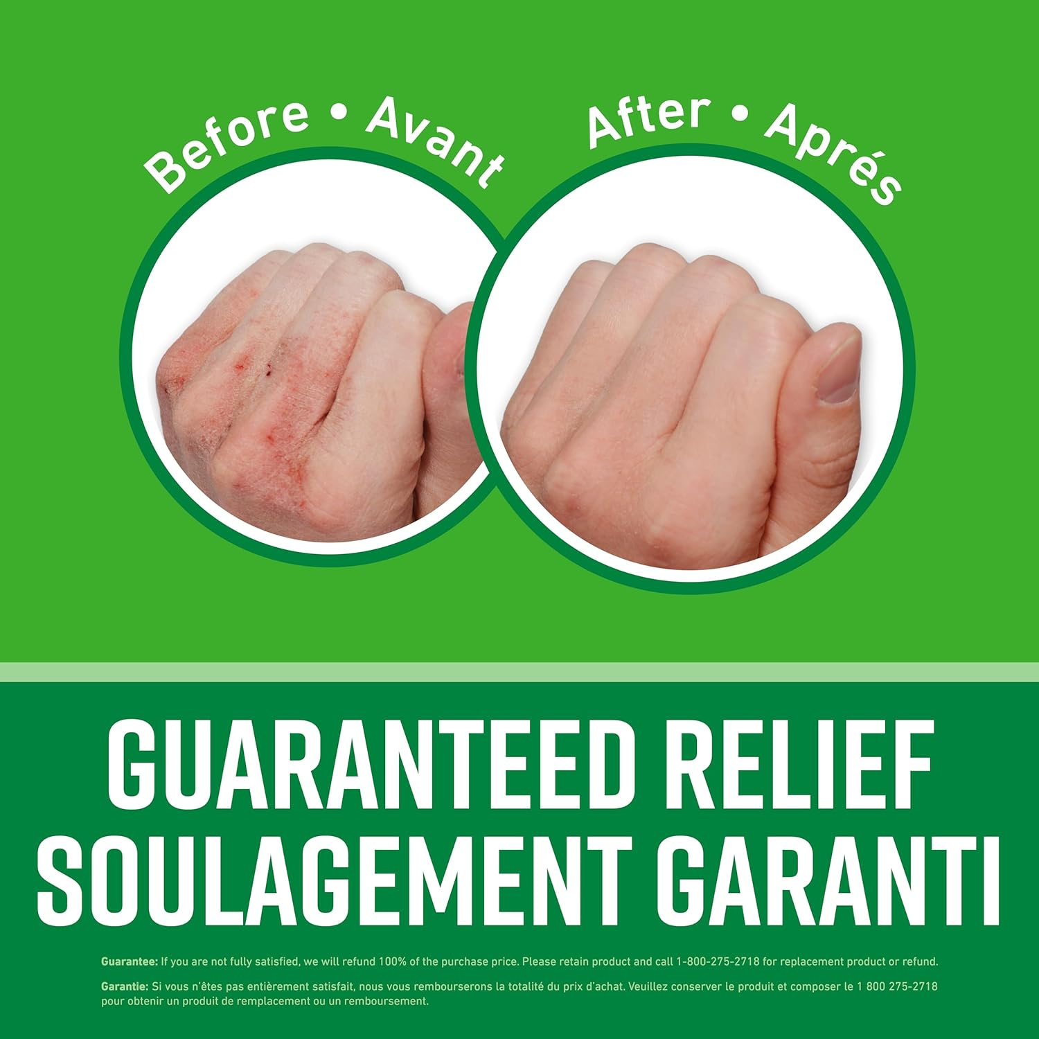 O'Keeffe'S Working Hands Hand Cream, 3.4 Ounce Jar image number 1