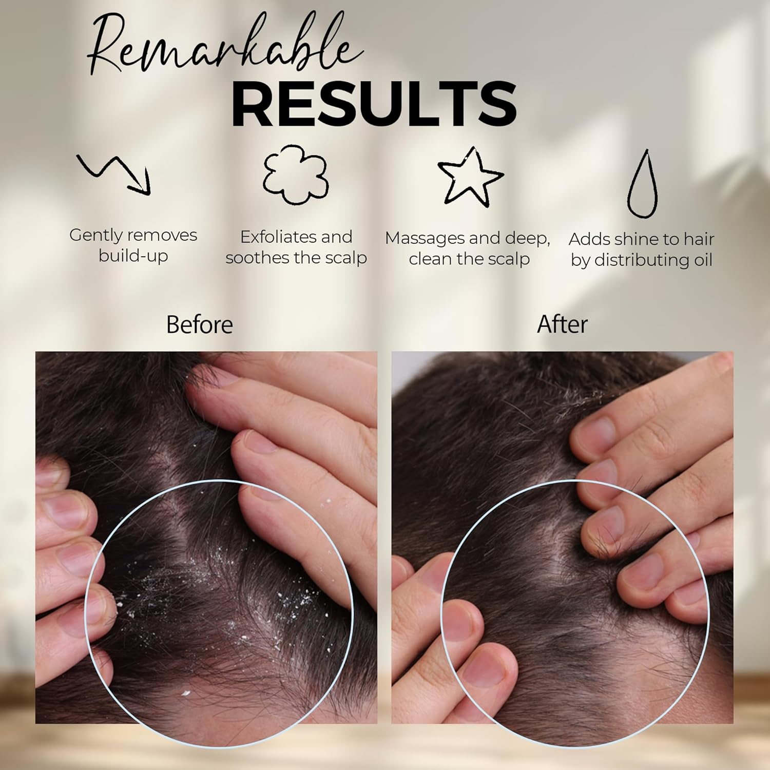 Fiora Naturals Scalp Massager Shampoo Brush - Silicon Scalp Scrubber & Exfoliator for Dandruff Removal and Hair Growth, Wet & Dry Hair, Men, Women, Kids - BPA Free - Marine image number 7