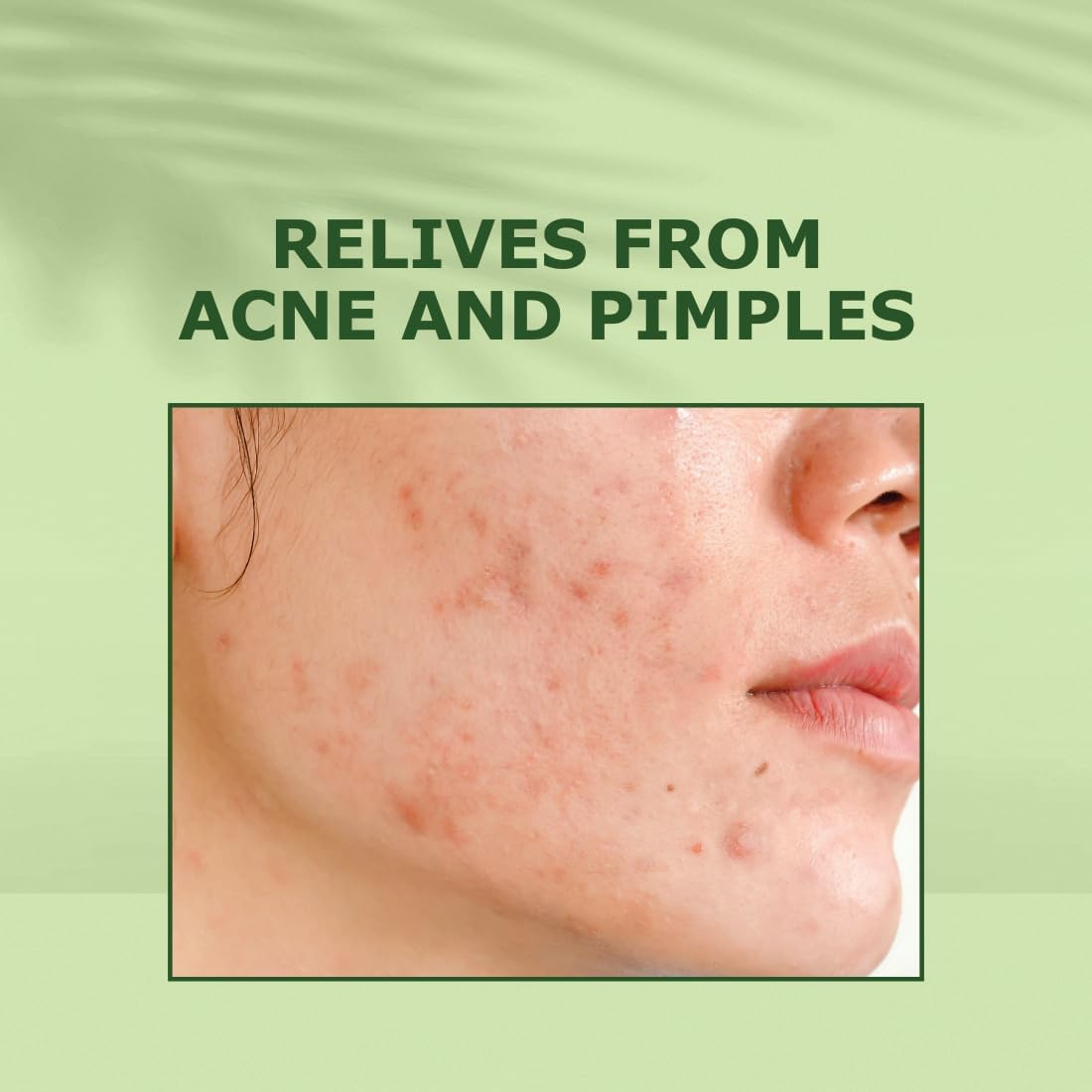 Nuerma Science Tea Tree & Rosemary Oil Hair Oil-100 ML image number 1