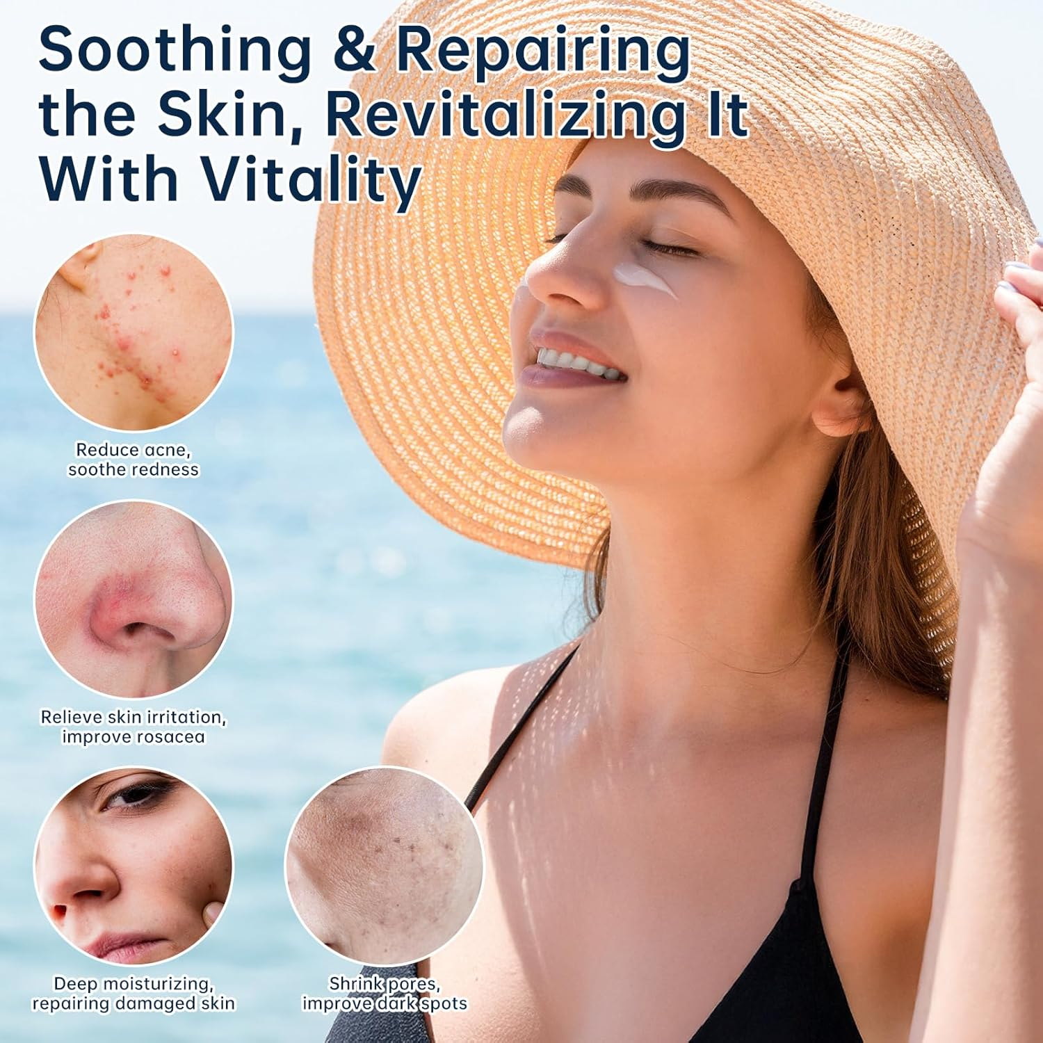 Azelaic Acid 14 Percent Cream for Face, Azelaic Acid Gel, 30ML Azelaic Acid Acne Cream with Salicylic Acid, Niacinamide & Vitamin C for Dark Spot. image number 1