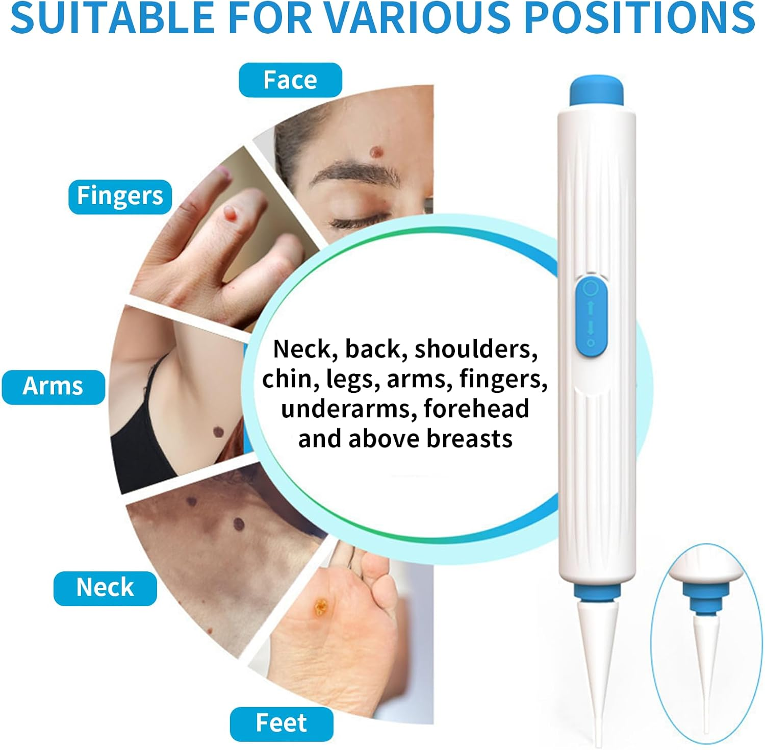 1 Pack Skin Tag, Removes Moles from Face and Body, Safely and Painlessly of Mole Remover Kitfast-Acting Skin Tag Remover, Effective Mole Remover, Precision Applicator for Smooth Skin image number 1