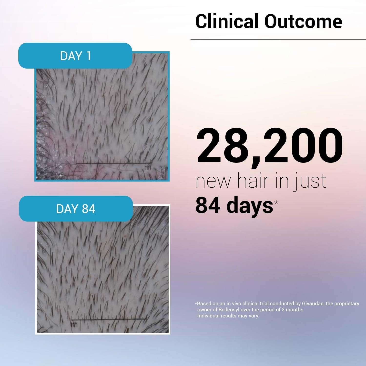 Sotrue Hair Growth Serum with Redensyl 3%, Procapil 3%, Anagain 4% and Baicapil 2% Hair Growth Actives, Stimulates Hair Growth, Hair Fall Control Serum for Women Men, for All Hair Types, 30Ml image number 4