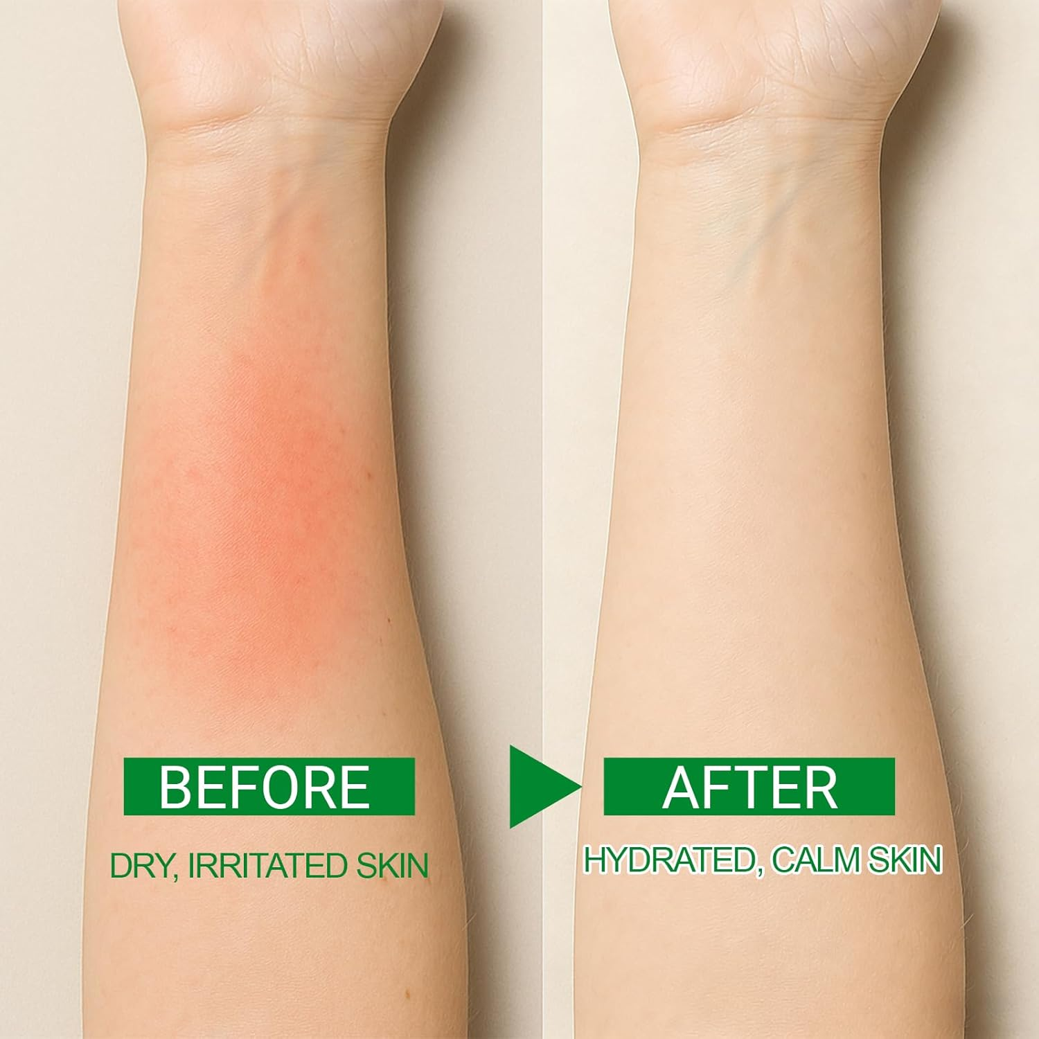 Erinde Aloe Vera Gel | 99% Pure Natural Aloe Gel for Moisturizing Face Skin & Hair Care,Durable Moisturizing Hydrating Soothing, Non-Sticky 30 PC Travel Size, after Sun Soothing Care