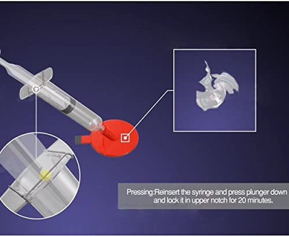 DIY Car Windshield Glass Chip Crack Repair Kit Windscreen image number 6