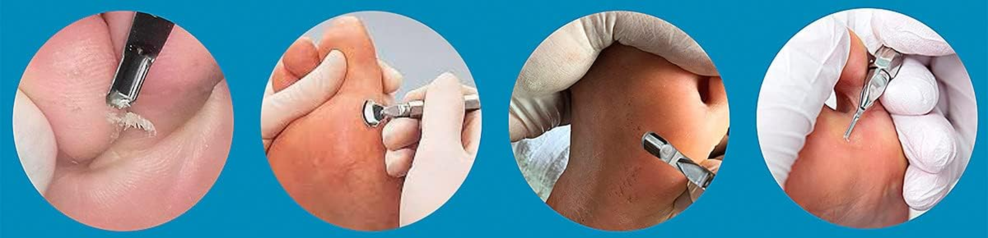 Set 4, 20 X Hollow Chisel Blades (2 X Each), 1 X Holder for Foot Care, 10 Sizes Mix Set Starter Set image number 1