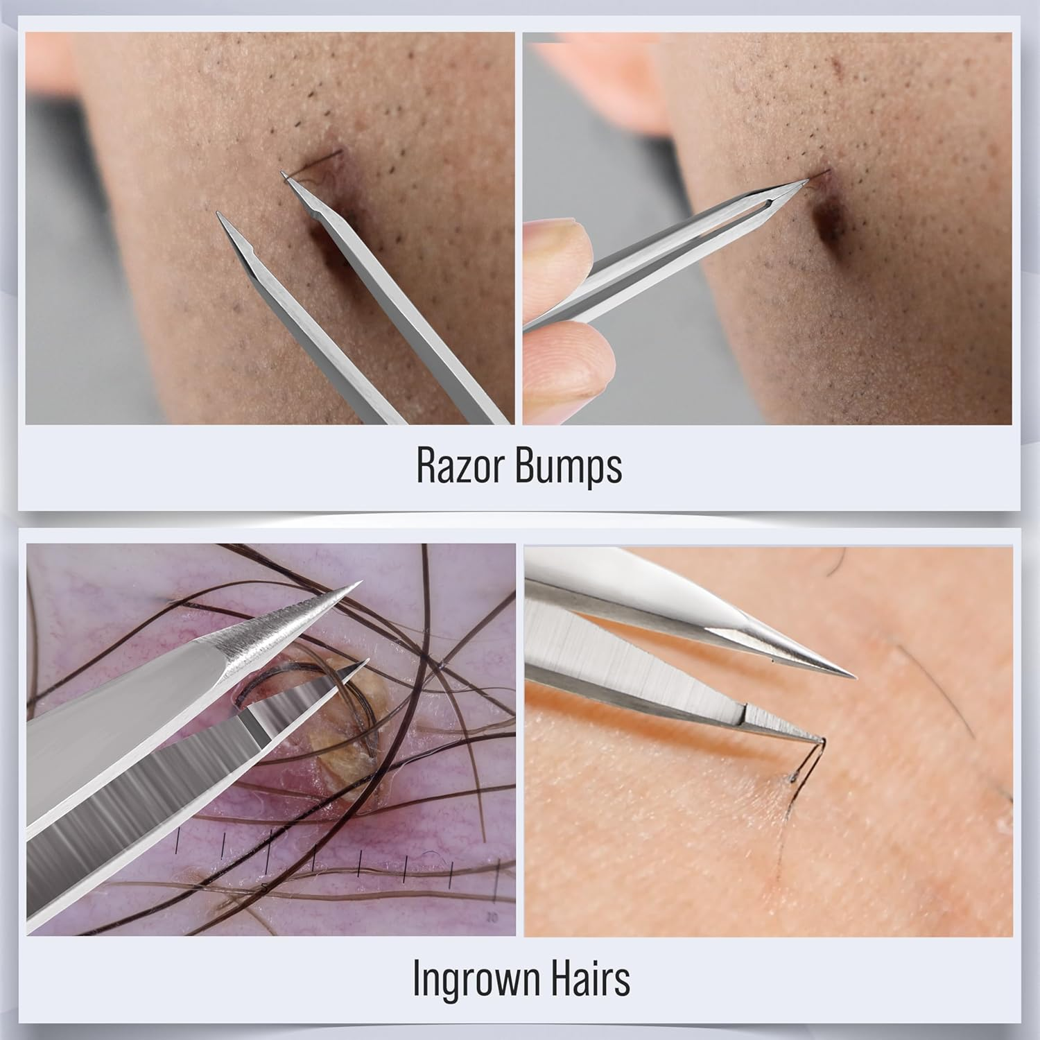 DUROX - Sharp Tweezers, Pointed Tweezers for Ingrown Hair Treatment, Needle Nose Tweezers to Remove Splinter Out, Premium Pointy Tweezers image number 2
