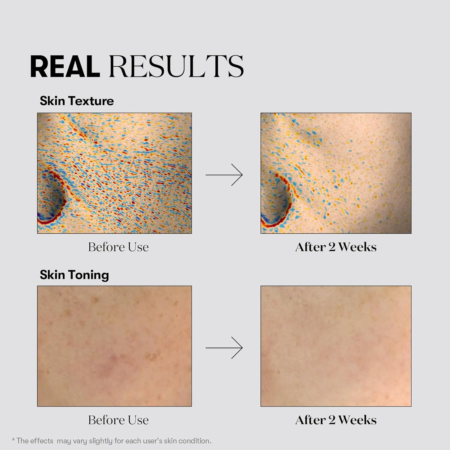 VT COSMETICS TX Toning Facial Toner with Tranexamic Acid, Niacinamide & Glutathione, Hydrating, Refreshing Toner, Dark Spots, Exfoliating, Sensitive Skin Care, Korean Skincare, Fragrance-Free image number 2