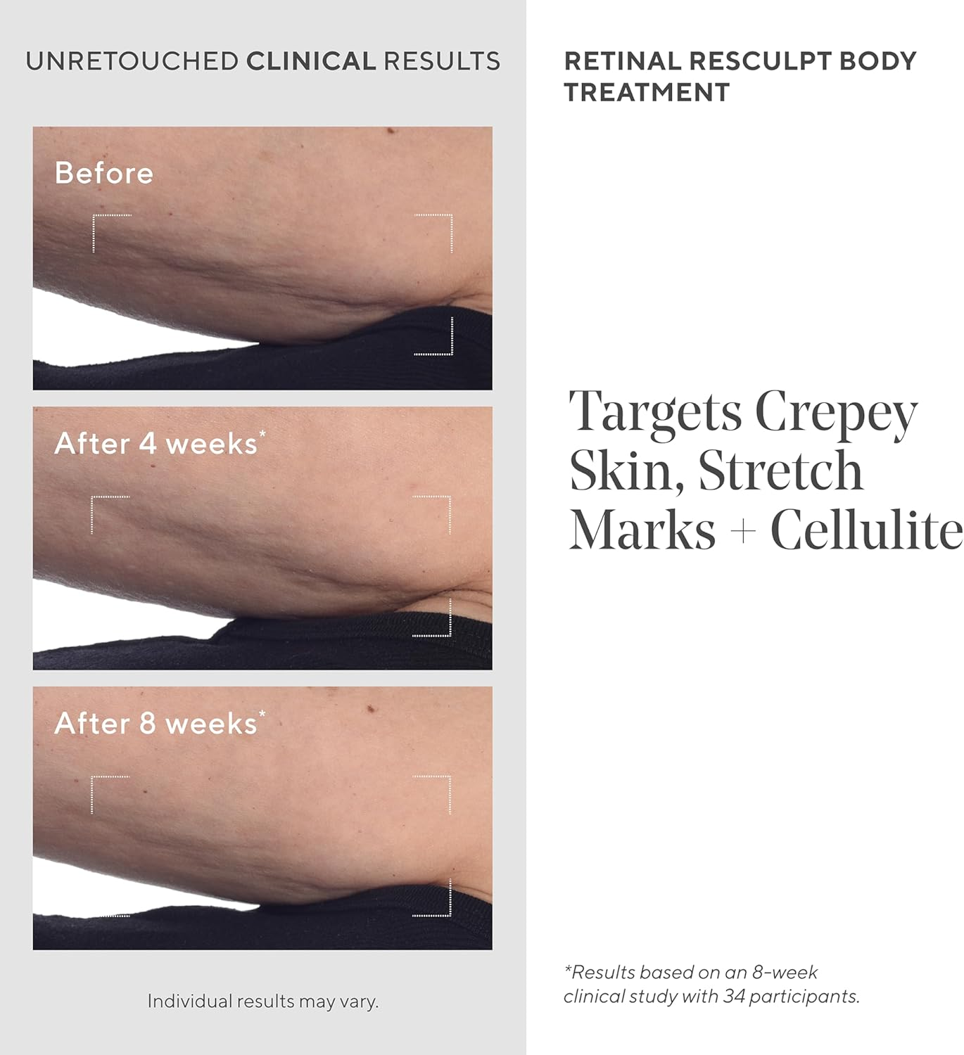 Murad Retinal Resculpt Body Treatment 148 Ml - Advanced Retinol Body Lotion for Skin Tightening and Firming, Targets Crepey Skin, Cellulite and Stretch Marks, Anti-Ageing Hydrating Body Moisturiser image number 2