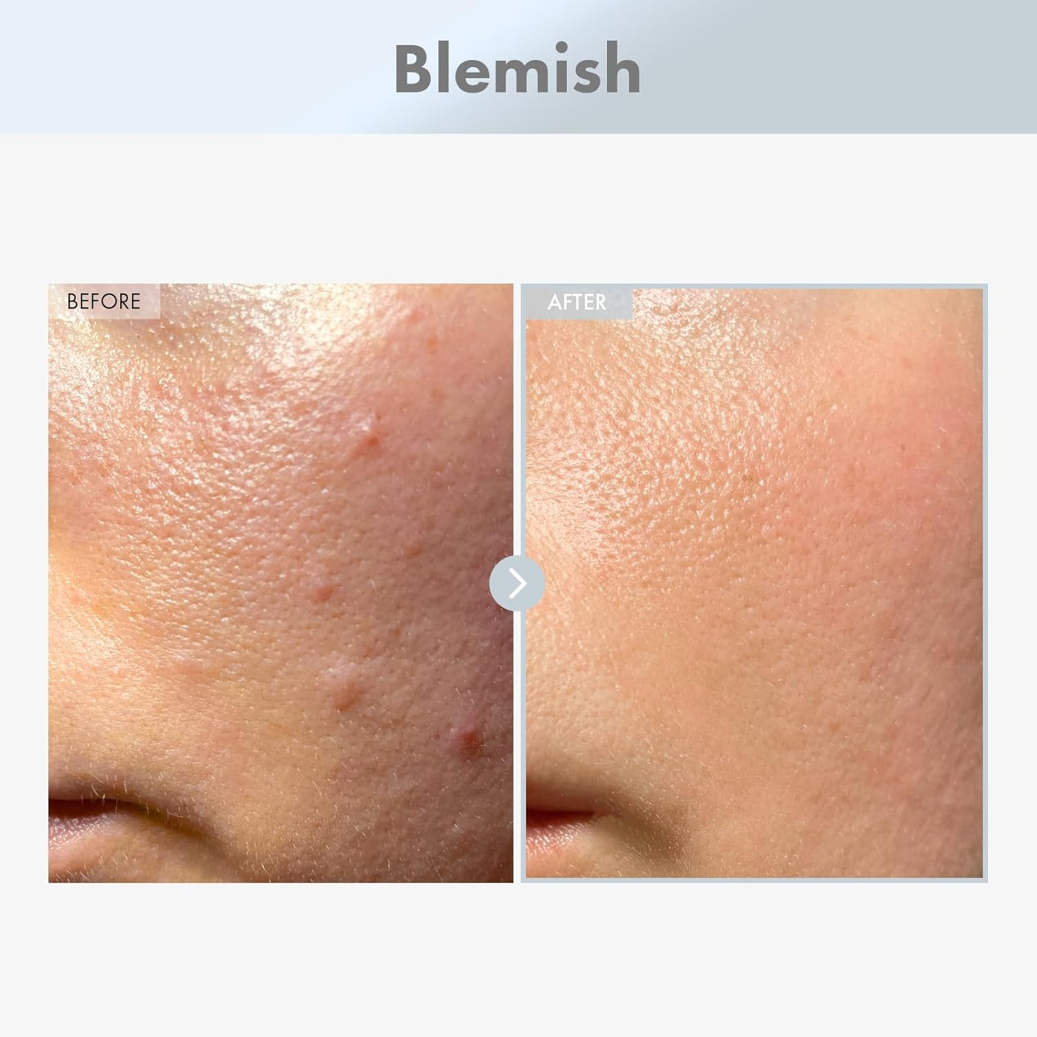 TOSOWOONG Niacinamide 15% Face Serum, 150,100Ppm Niacinamide, Tranexamic Acid, Dark Spot Corrector, Glass Skin, Radiant Complexion, Pore Minimizer, Even Skin Tone, Korean Skin Care, 30Ml, 1.01 Fl.Oz. image number 4