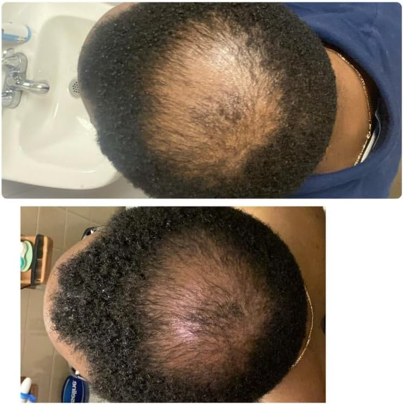 Deep Conditioner Mask for Hair Repair by Kreyol Essence, 240Ml