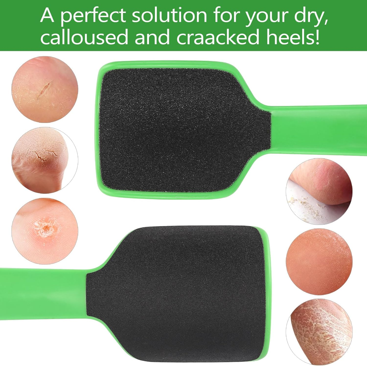 2 Pcs Curved Foot File Callus Remover for Feet, Double Sided Heel File Scraper U Shaped Foot Scrubber Dead Skin Remover image number 1