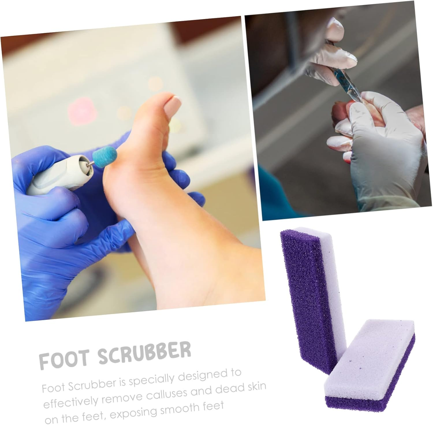 Garneck 2Pcs Foot Pumice Stone for Callus Removal Eco-Friendly Dead Skin Exfoliator Comfortable Grip Foot Care Scrubber Purple Color