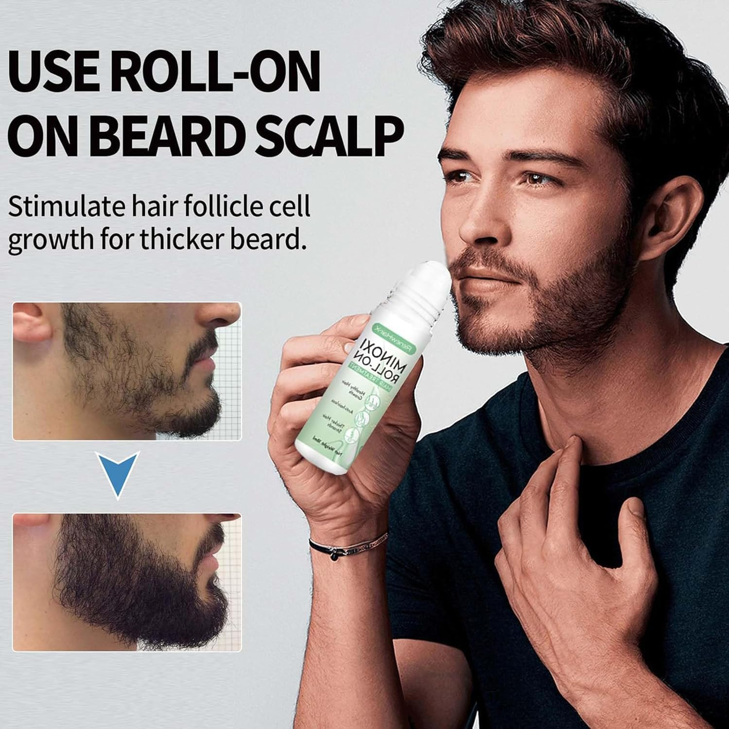 3 Pcs Renew Hair X Roll-On Hair Treatment,Renewhairx Hair and Beard Regrowth Roll on Serum,Beard Hair Regrowth Treatment Works on All Hair