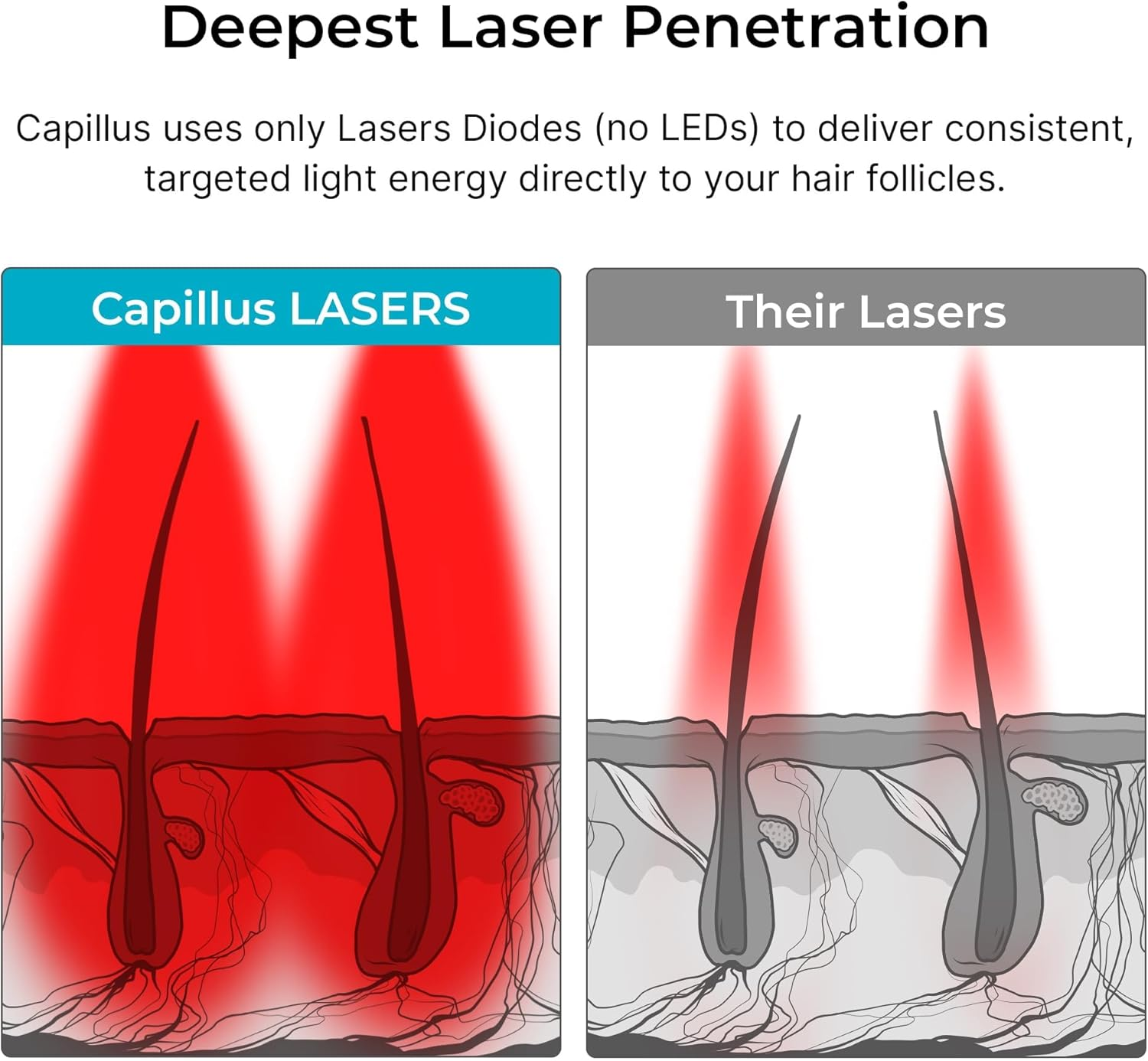 Capillus Pro S1 Red Light Therapy for Hair Growth Hair Red Light Therapy Red Light Cap for Hair Regrowth, 304 Laser Cap for Hair Regrowth Red Light Hair Therapy Laser Hair Growth Cap image number 1