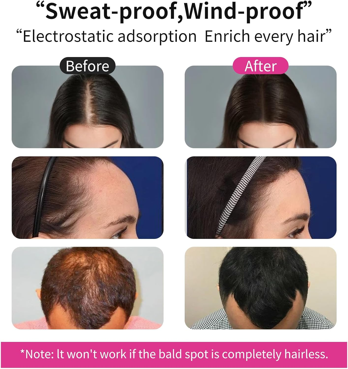 Sevich Hair Fibers - Hair Rebuilding Fibers Original Refill, Nature Keratin Fibers for Thin Hair, 100G - Medium Brown image number 6