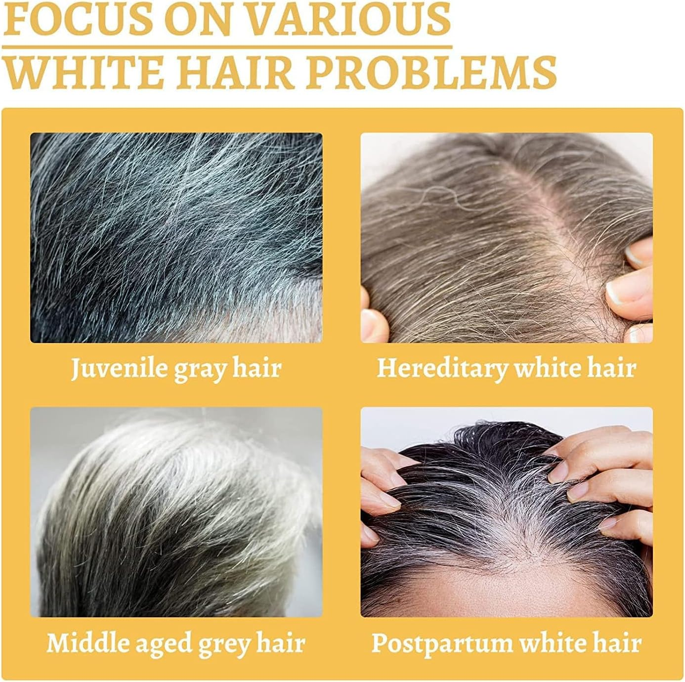 Anti-Grey Hair Treatment 30Ml,Restore Hair Natural Color, Ganoderma Nutrient Natural Darkening,Grey Hair Coverage Serum Promotes Fuller - 1Pcs image number 2