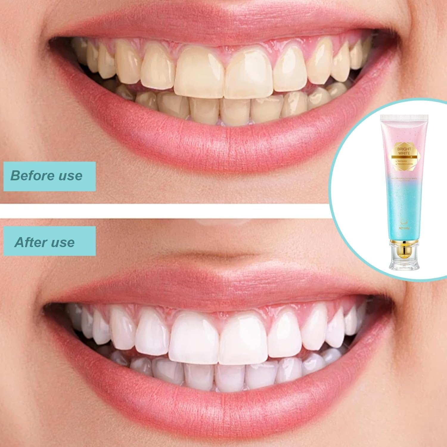 2 PCS Niacinamide Toothpaste, Natural Niacinamide Whitening Toothpaste with Brighter Teeth, Improves Gum Health, Remove Tooth Stains, Fresh Breath, Gentle Formula for Sensitive Teeth image number 3