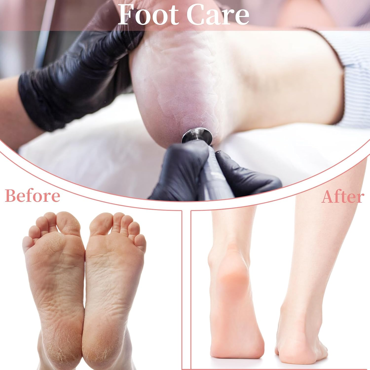 72Pcs Sanding Paper Discs and 25Mm Metal Nail Drill Bit Replacement Sandpaper Disk, Foot File for Dead Skin Foot Callus Remover for Manicure Pedicure Supplies Tools(80#150#240# Grits)