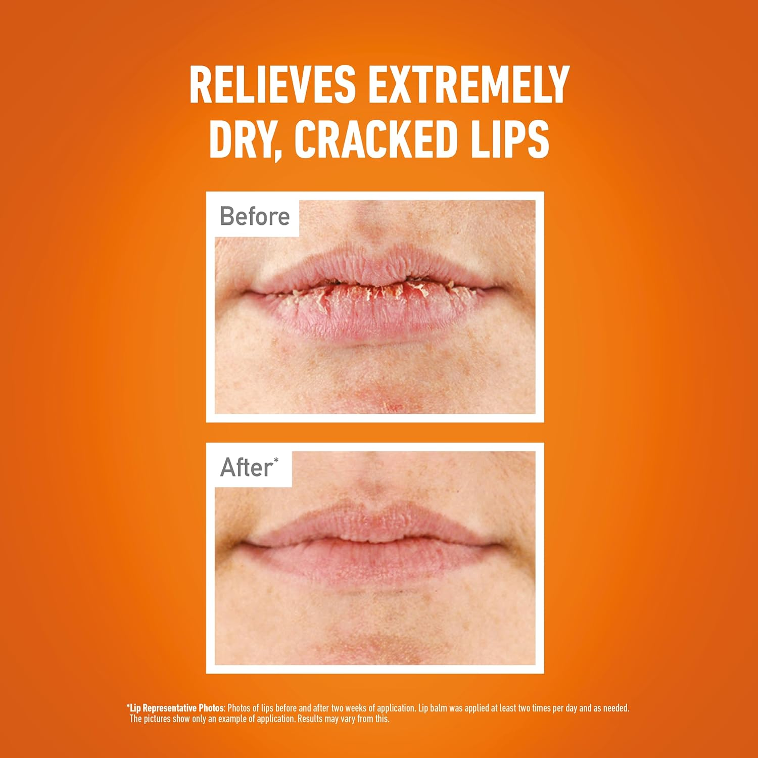 O'Keeffe'S Lip Repair SPF15 Balm, Opaque, 4.2 G (Pack of 3) image number 2