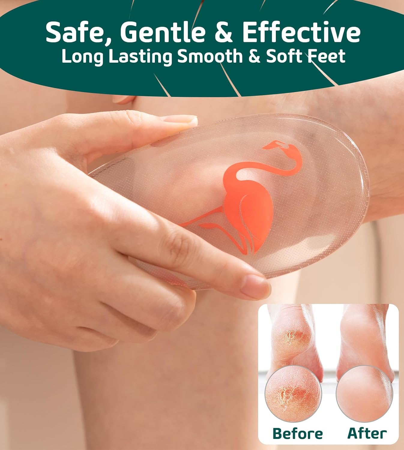 Sunivaca Glass Foot File Callus Remover for Feet, Flamingo Gifts for Women, Foot Scrubber Dead Skin Remover, Professional Pedicure Tools at Home, Heel Scraper for Cracked Heels image number 2