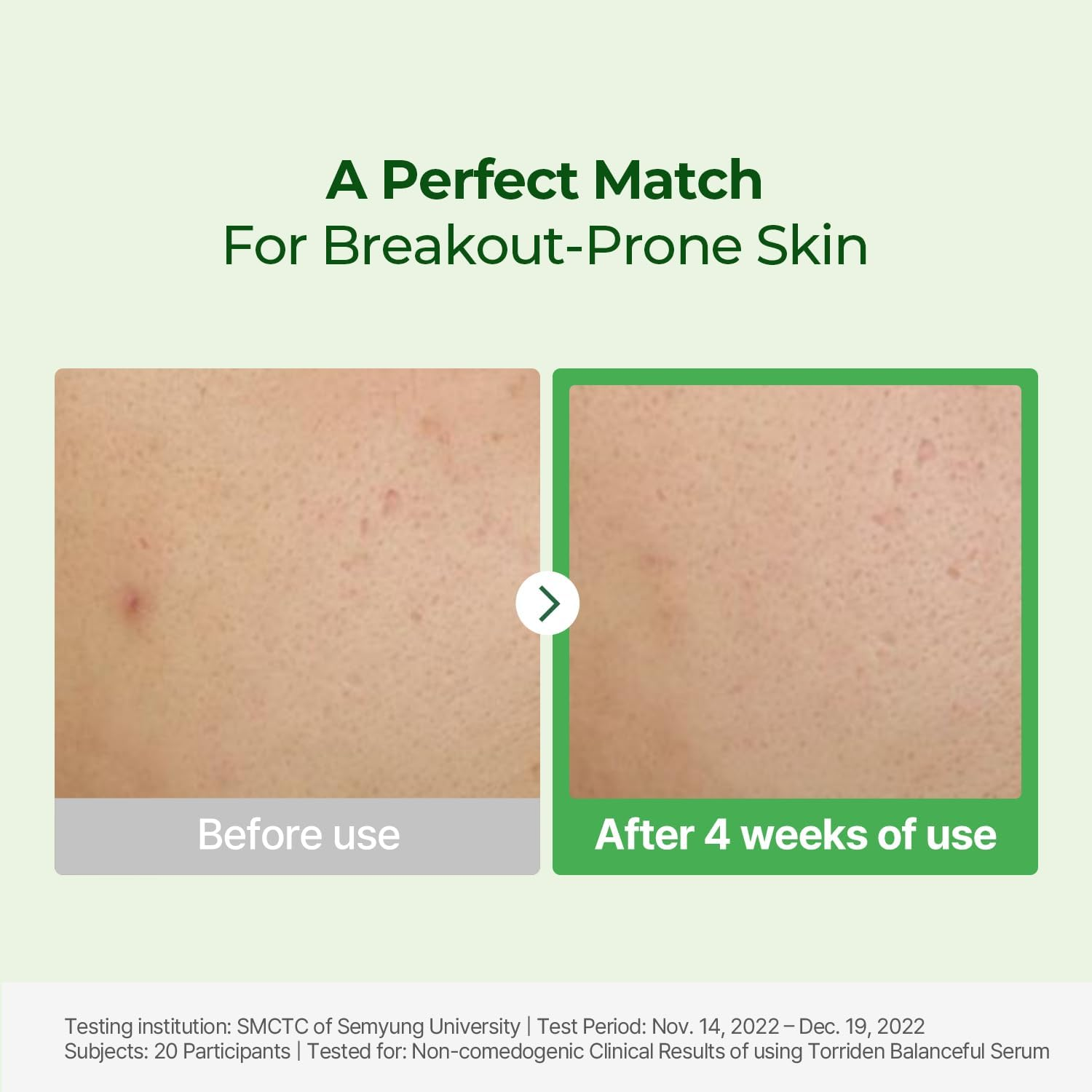 Torriden BALANCEFUL Serum 50Ml (1.69 Fl.Oz.) | Instant Soothing and Balancing Care for Sensitive Skin | 5D CICA, Hydrolyzed Hyaluronic Acid, Panthenol | Korean Facial Serum image number 2