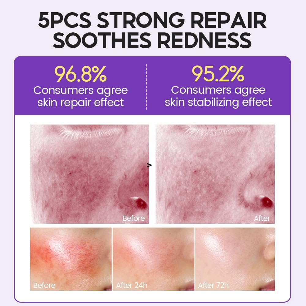 1.2% Retinol Serum Ultra-Hydrating Single-Use Vials 15 Pcs/Anti-Aging & Anti-Wrinkle,With Pro-Xylane, Niacinamide,Hyaluronic Acid,Copper Peptide for a Youthful, Hydrated, and Radiant Complexion image number 4