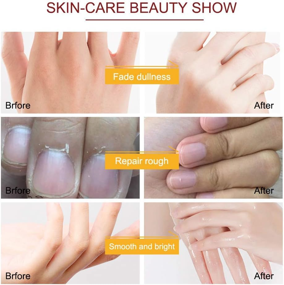 Hand Mask, 5 Pairs Hand Moisturizing Gloves Repairing Hand Mask for Extra Dry Skin Spa Masks, Exfoliating Hand Peeling Mask, Repair Rough Skin for Men & Women (C) image number 5