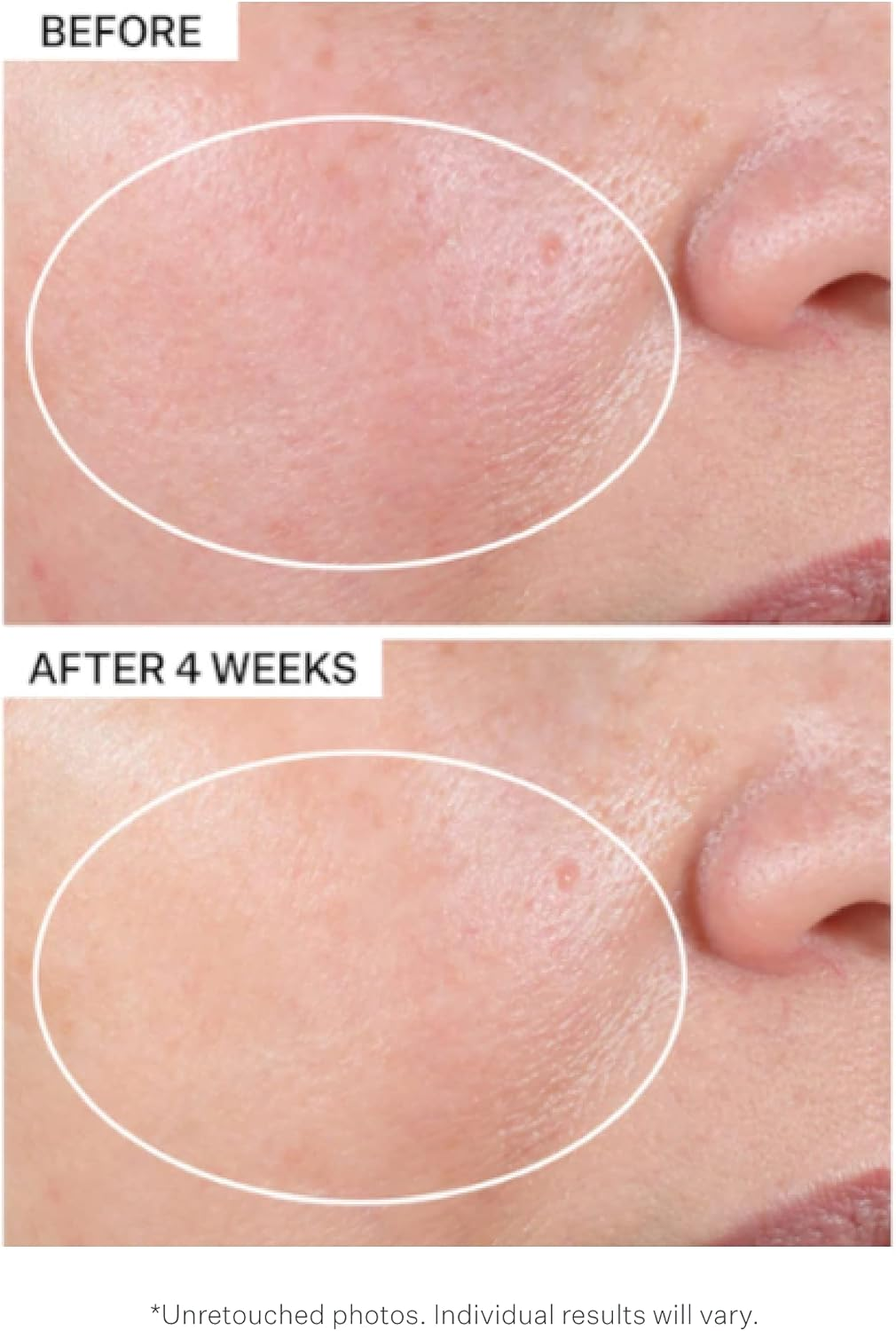 Strivectin Advanced Retinol Intensive Night Moisturizer for Unisex 1 Oz Moisturizer