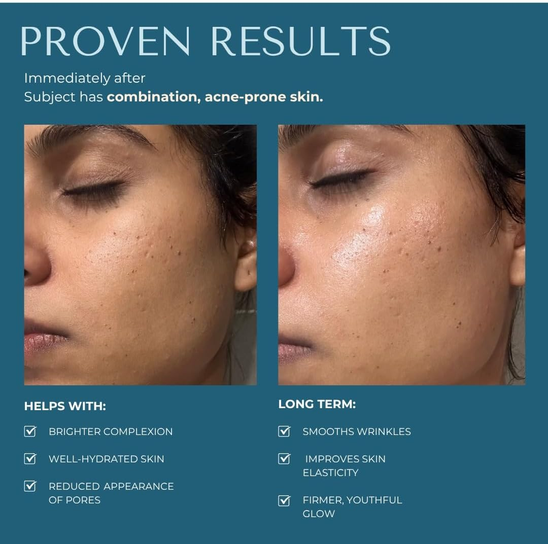 KAASHI Essentials Skincare Bundle &ndash; 4-Step Facial Kit with Cleanser, Brightening Serum, Retinol Night Treatment & Hydrating Moisturiser &ndash; Anti-Ageing, Acne Control, Glowing Skin Care Routine image number 6