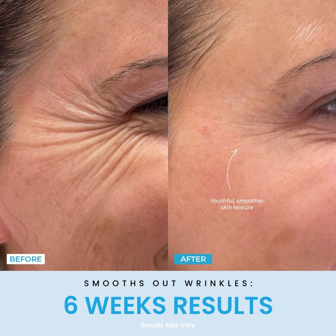 LED Face and Neck Massager &ndash; Liftlab 3-In-1 Beauty Sculptor with Red, Blue and Green Light Modes &ndash; At-Home Skincare Tool with Vibration Massage and Improved Battery image number 2