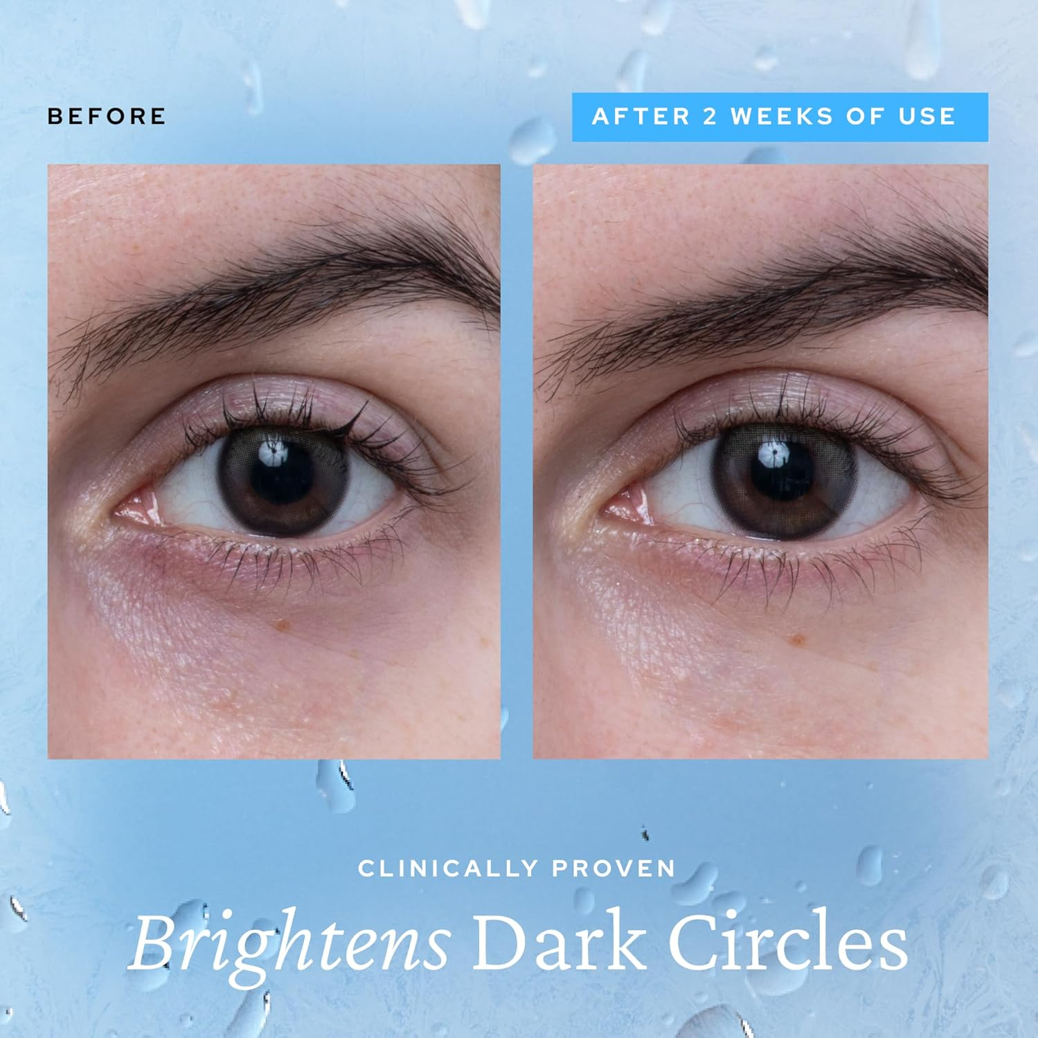 Belif Aqua Bomb Cooling Eye Gel - Caffeine & Hyaluronic Acid for Puffiness & Hydration, Niacinamide & Vitamin C for Dark Circles, Adenosine & Collagen for Plumping & Firming, Korean Skin Care image number 5