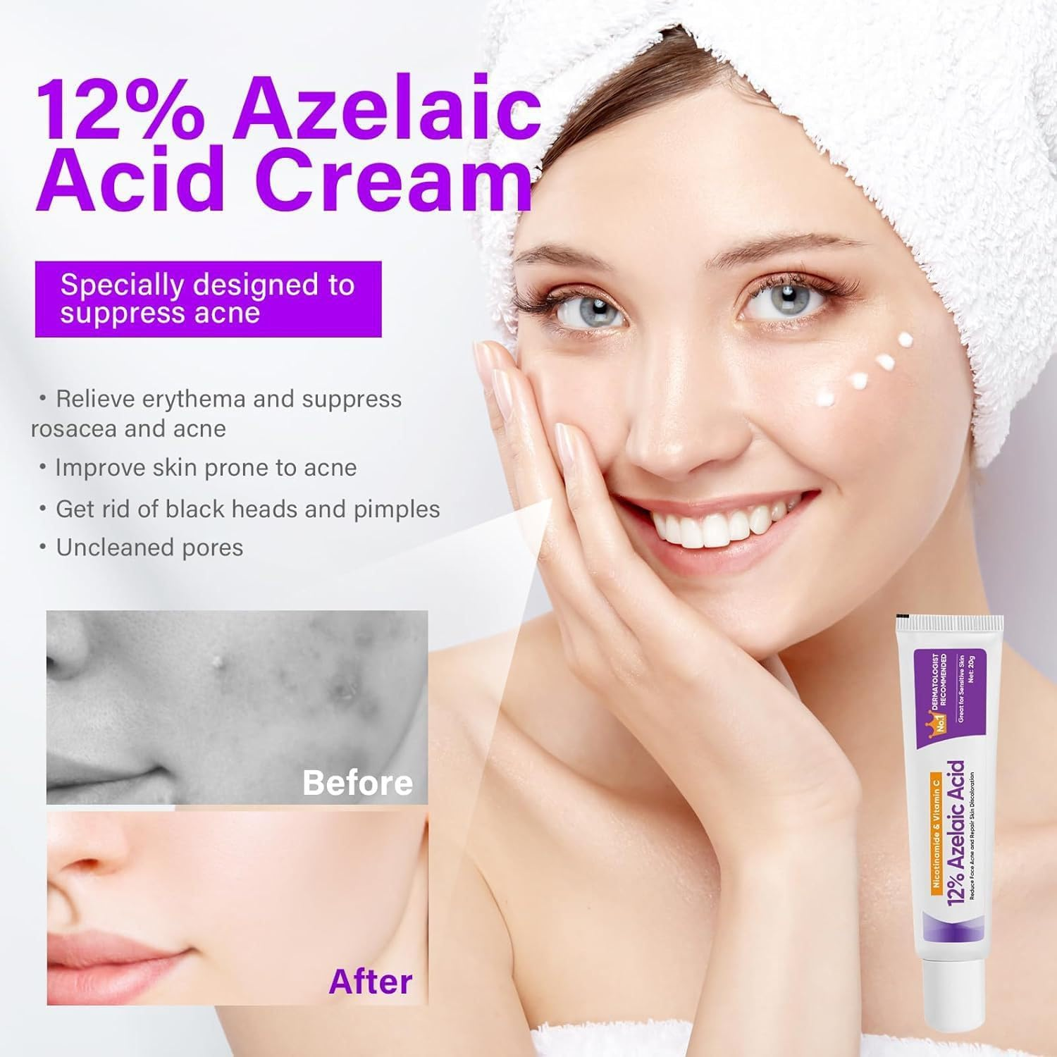 Azelaic Acid 12% Serum for Face with Niacinamide & Vitamin C Refining Skin Texture,Reduce Blemish Visibility,Support Skin Barrier Moisture Retention, Improve Tone Evenness (2 Packs) image number 1