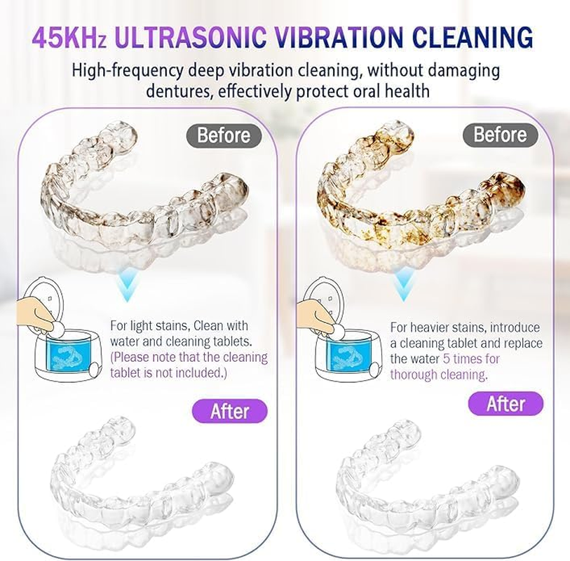 Gisaae UV Ultrasonic Retainer Cleaner, Portable Ultrasonic Cleaner, 45Khz Retainer Cleaner Machine for Dentures, Mouth Guards, Braces, Toothbrush Heads, Jewelry with 250ML Capacity, Retainer Cleaning for All Dental Appliances image number 3