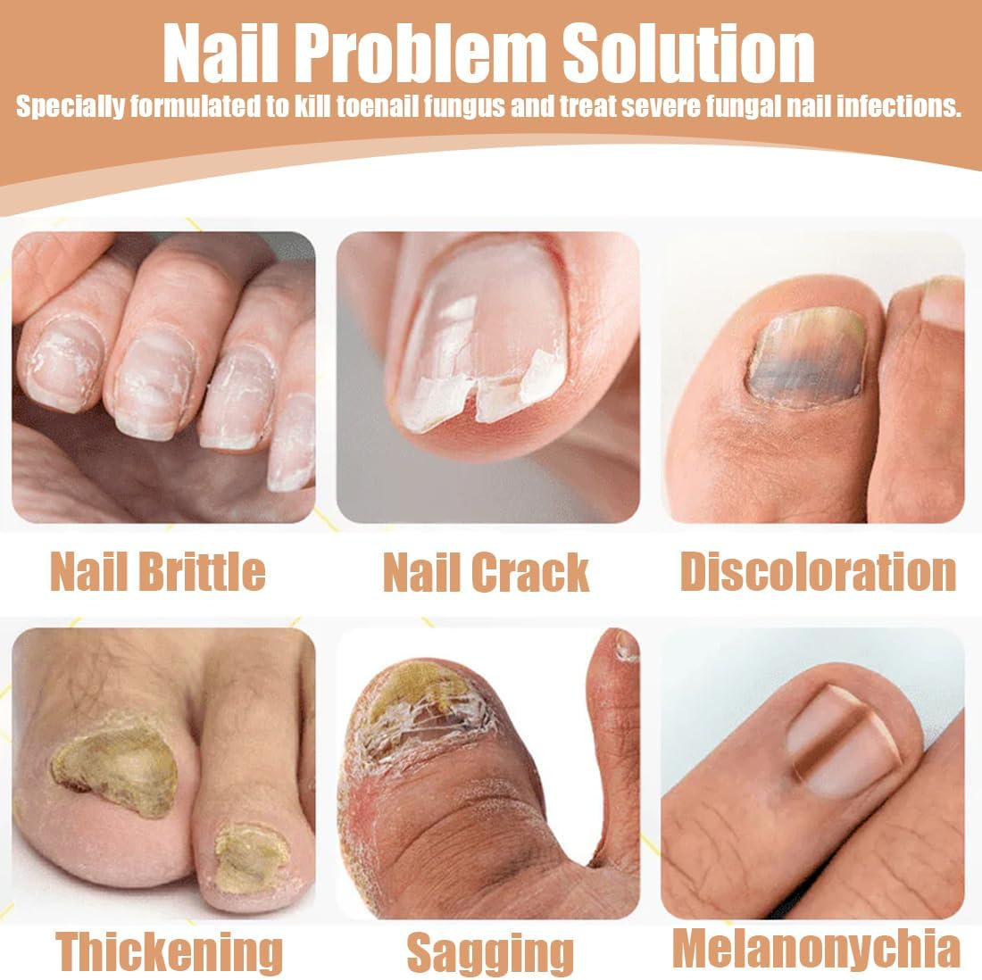 LQIOACU Pack of 32 Toenail Treatment, Split Nail Repair Strengthening Nails, Nail Digging Repair Plasters for Damaged and the Appearance of Discoloured Nails image number 3