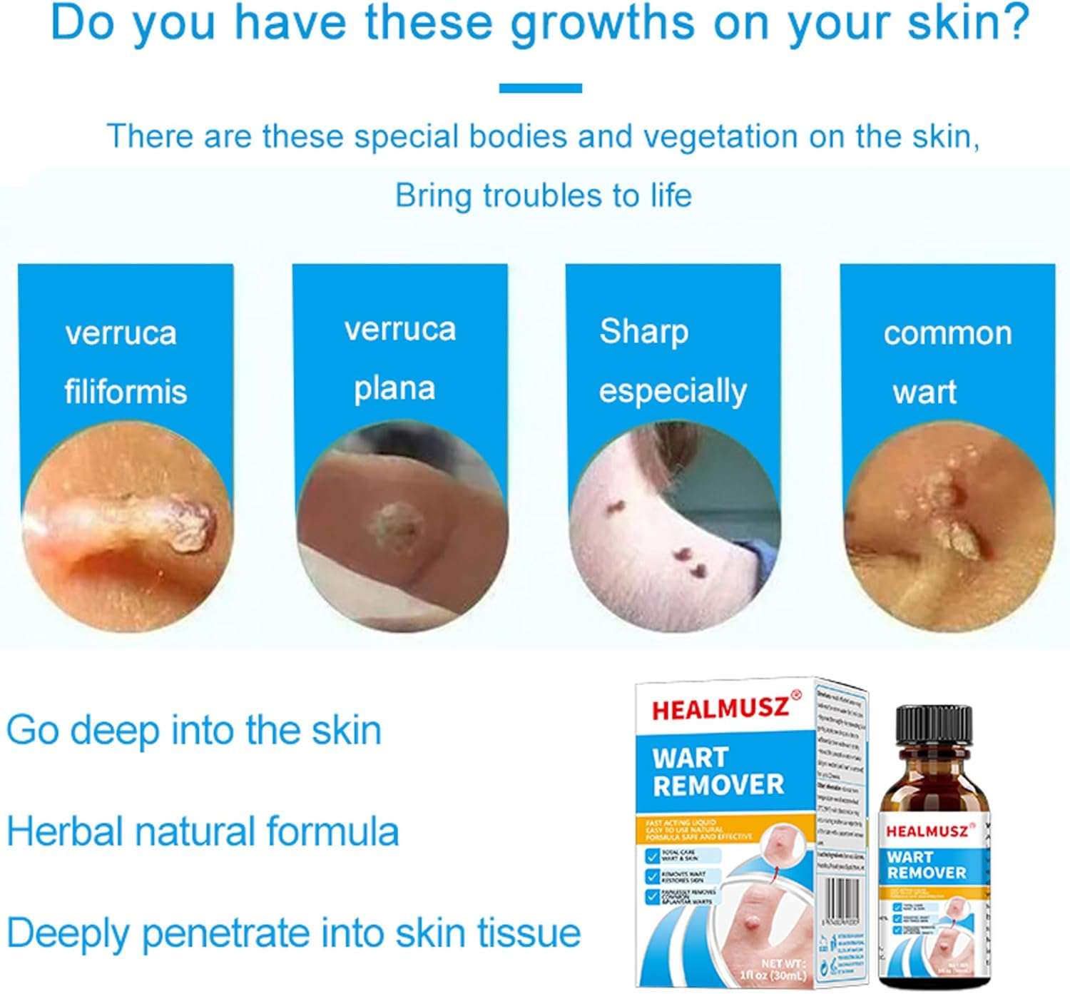 Skin-Tag-Remover, Wart Remover, Mole & Wart-Remover Liquid, Fast-Acting Skin-Tag-Remover for Tag Removal & Verruca-Treatment image number 5