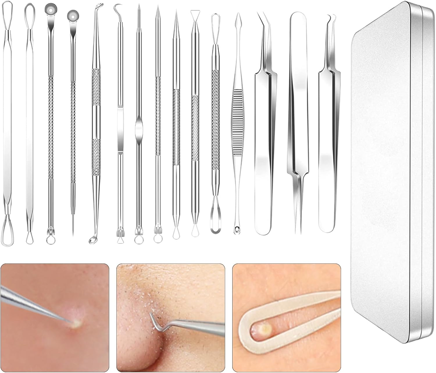 15PCS Heads Blackhead Remover, Pimple Comedone Extractor, Acne Whitehead Blemish Removal Kit, Premium Stainless Steel,With Metal Case (Silver) image number 6