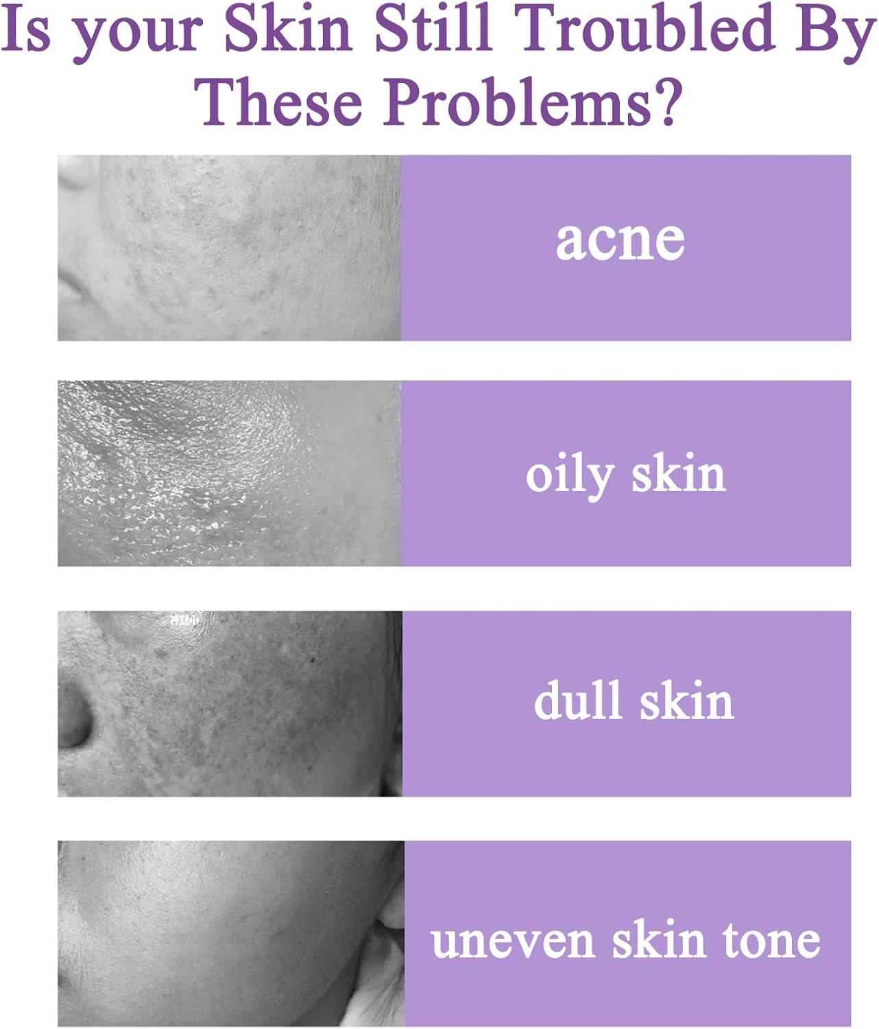 12% Azelaic Acid Serum - Brightens Skin, Clears Pores, Soothings Acne & Redness | Premium Face Treatment image number 2