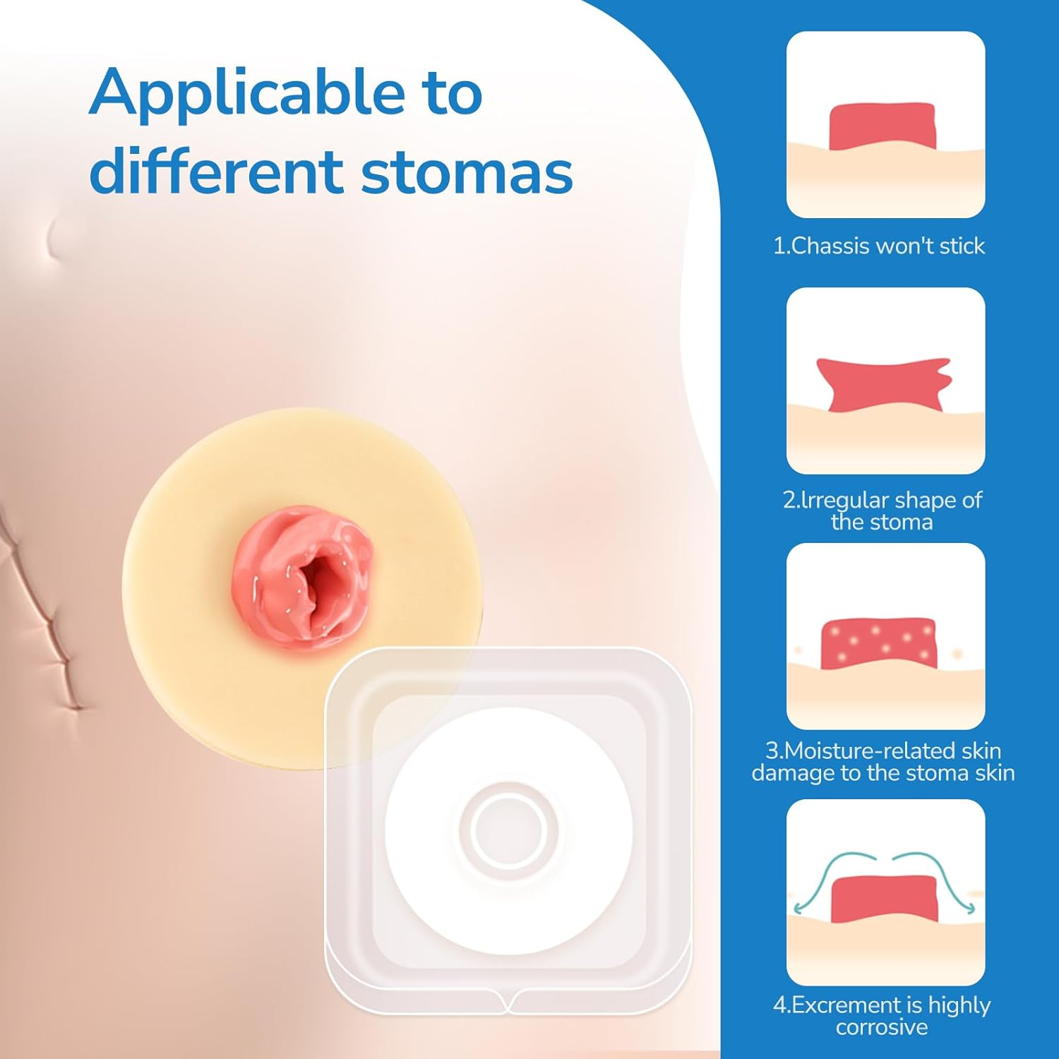 Ostomy Barrier Rings, 10Pcs Ostomy Medical Supplies Barrier Ring Better Seal for Ostomy Bags Compatible with All Bag Types and Brands, Outer Diameter: 4Mm Thickness (Box of 10)