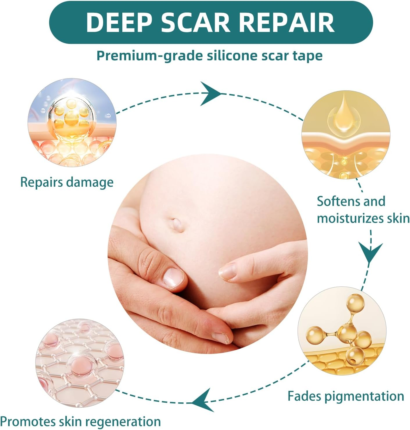 Silicone Scar Tape for Surgical Scars: Medical Grade Scar Gel Sheets for C-Section Tummy Tuck Recovery and Treatment &ndash; Reusable Scar Strips for Keloid Burn Acne Scars Removal (1.6'' X 60''Roll-1.5M) image number 4