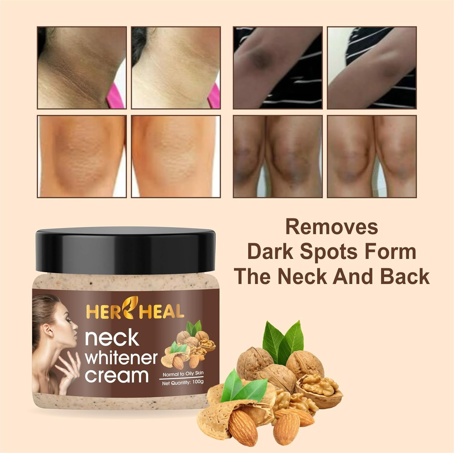 HER HEAL Neck Cream for Acanthosis Nigricans | for Dark Body Parts like Neck, Ankles, Knuckles, Armpits, Thighs, Elbows| Exfoliant 100Gm PACK Of-3(300Gm) image number 3