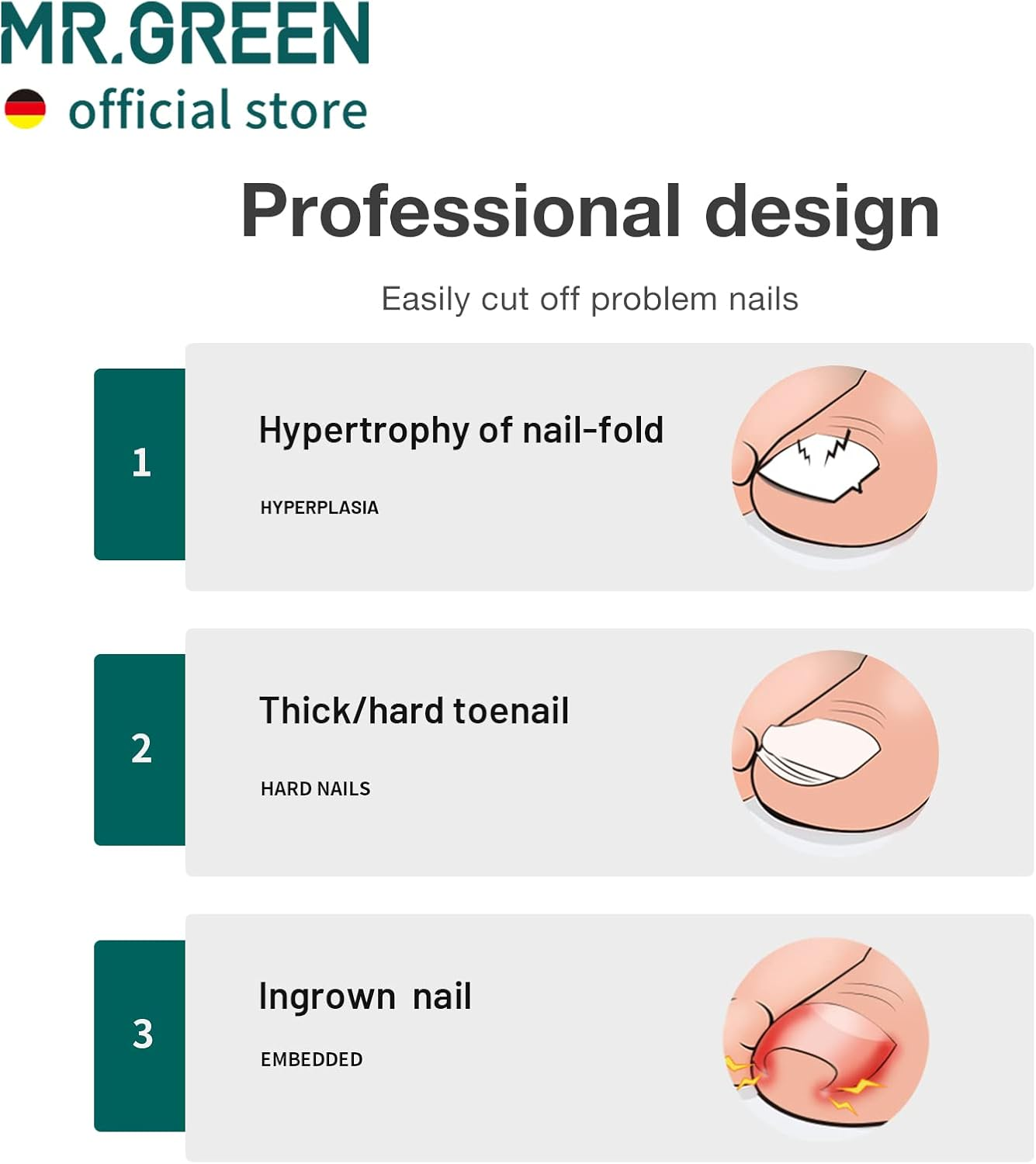 MR.GREEN Toenail Clippers Stainless Steel Ingrown Nail Cutter Thick and Hard Nails Pedicure Manicure Tools (Orange+Nail Remover)