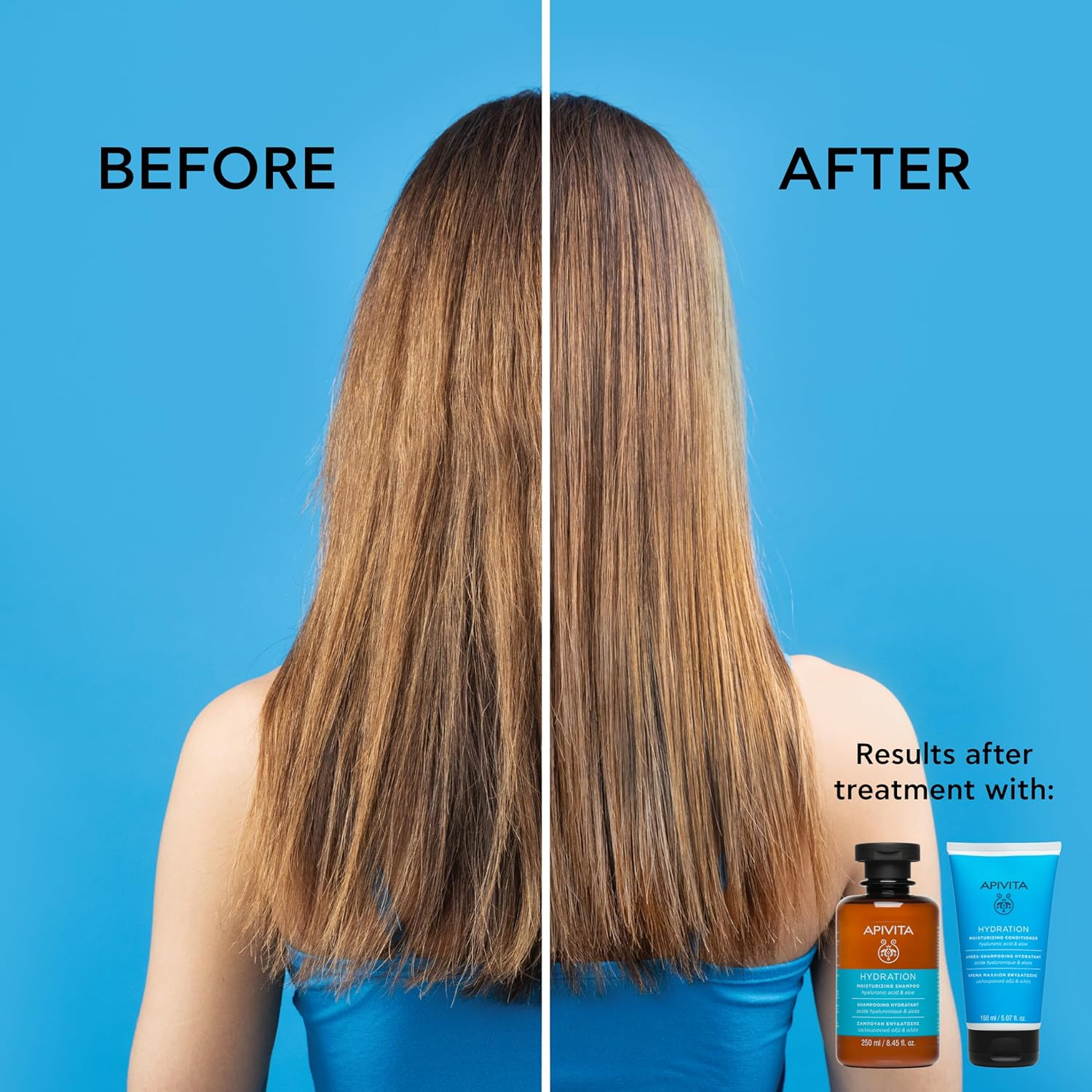 APIVITA Hydration Moisturizing Shampoo 8.45 Fl.Oz. | Natural Shampoo with Hyaluronic Acid & Aloe Vera for Intense Hydration, Prevents Split Ends, Eliminates Frizz | Daily Haircare for All Hair Types