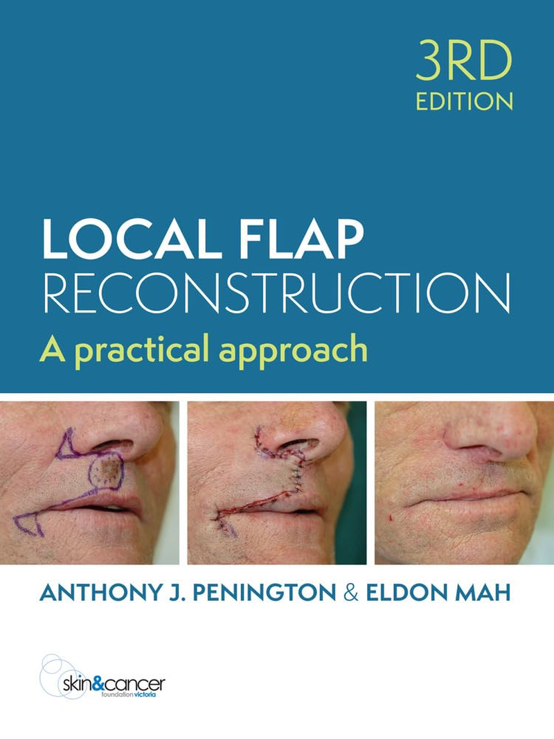 Local Flap Reconstruction, 3Rd Edition