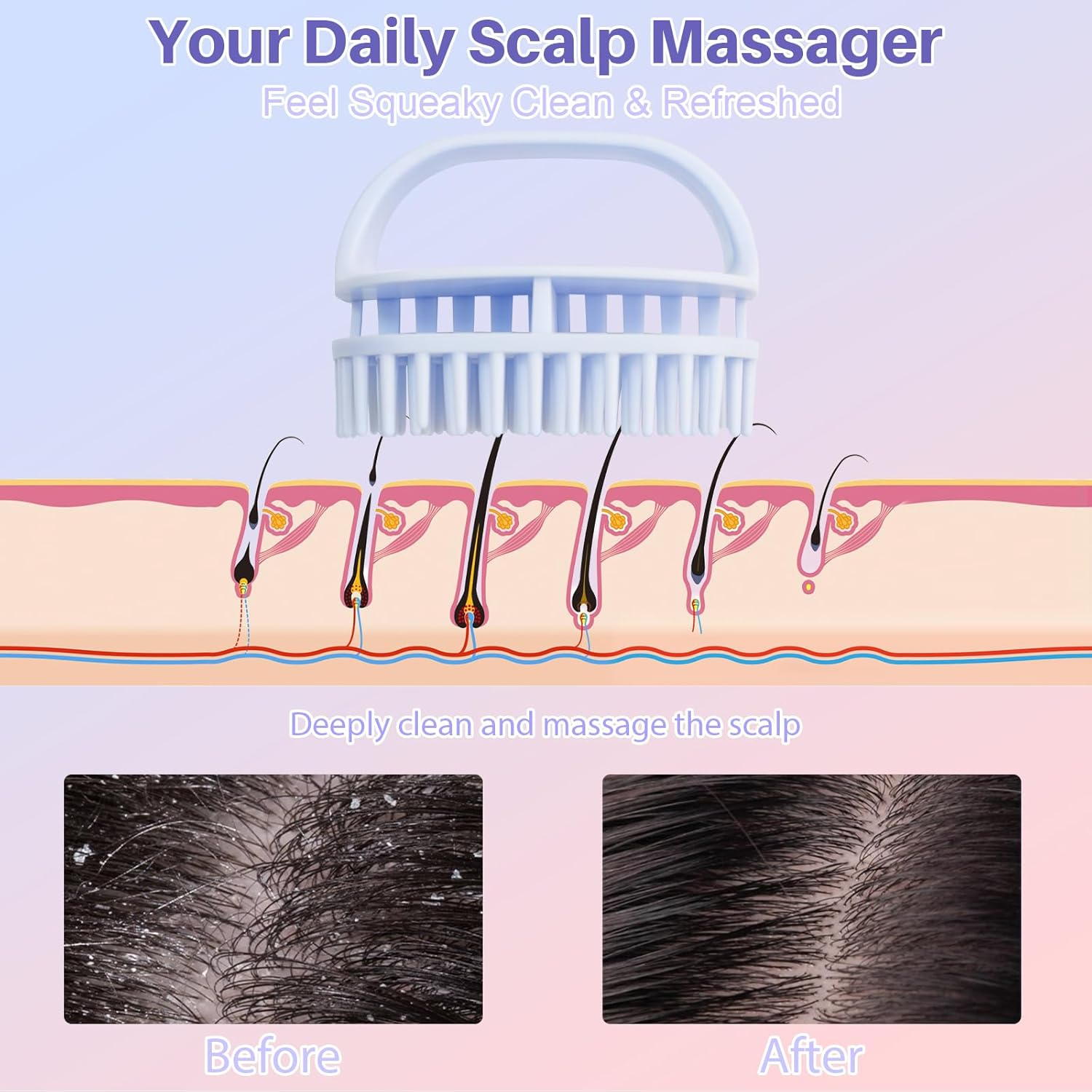 DUAIU Scalp Massage Brush with Hair Oil Applicator, 2 Pieces Silicone Head Massage Brush and 1 Piece Hair Oil Applicator, Massage Brush Hair Applicator Bottle Hair Kit Hair Growth Accelerate image number 2