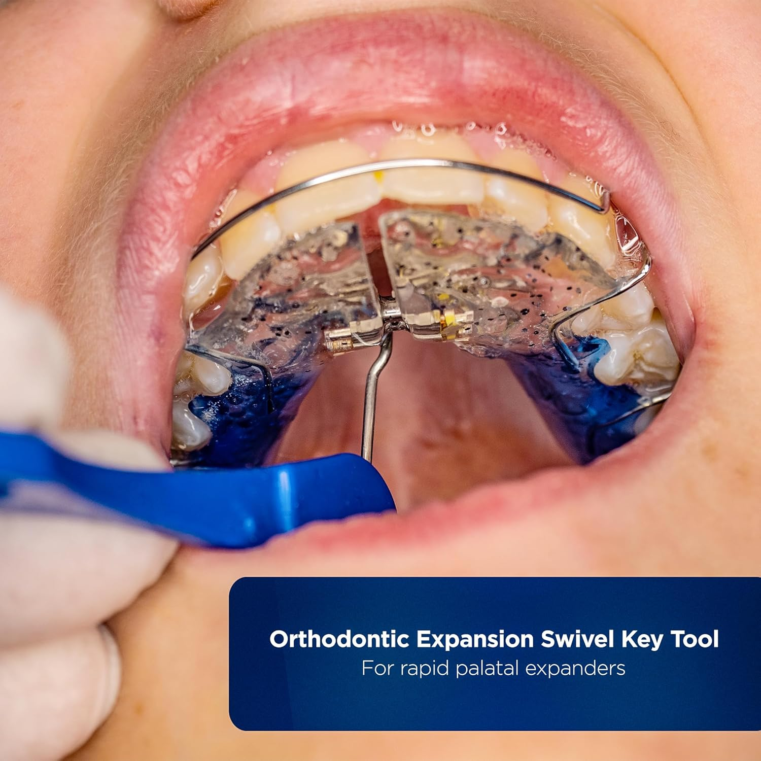 Galvanox Dental Orthodontic Expansion Swivel Key Tool for Palatal Expanders (3 Pack) image number 3