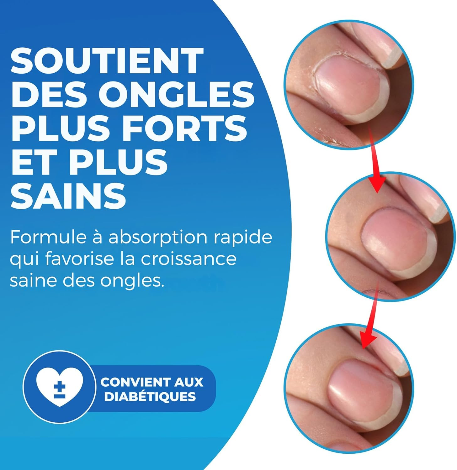 Imperial Feet Cuticle Oil for Nails 30Ml (1 FL Oz)-Cuticle Remover Liquid Nail Strengthener with Almond Oil, Jojoba Oil & Vitamin E Oil-Natural Nail Strengthener for Damaged Nails-Ideal for Diabetics image number 2