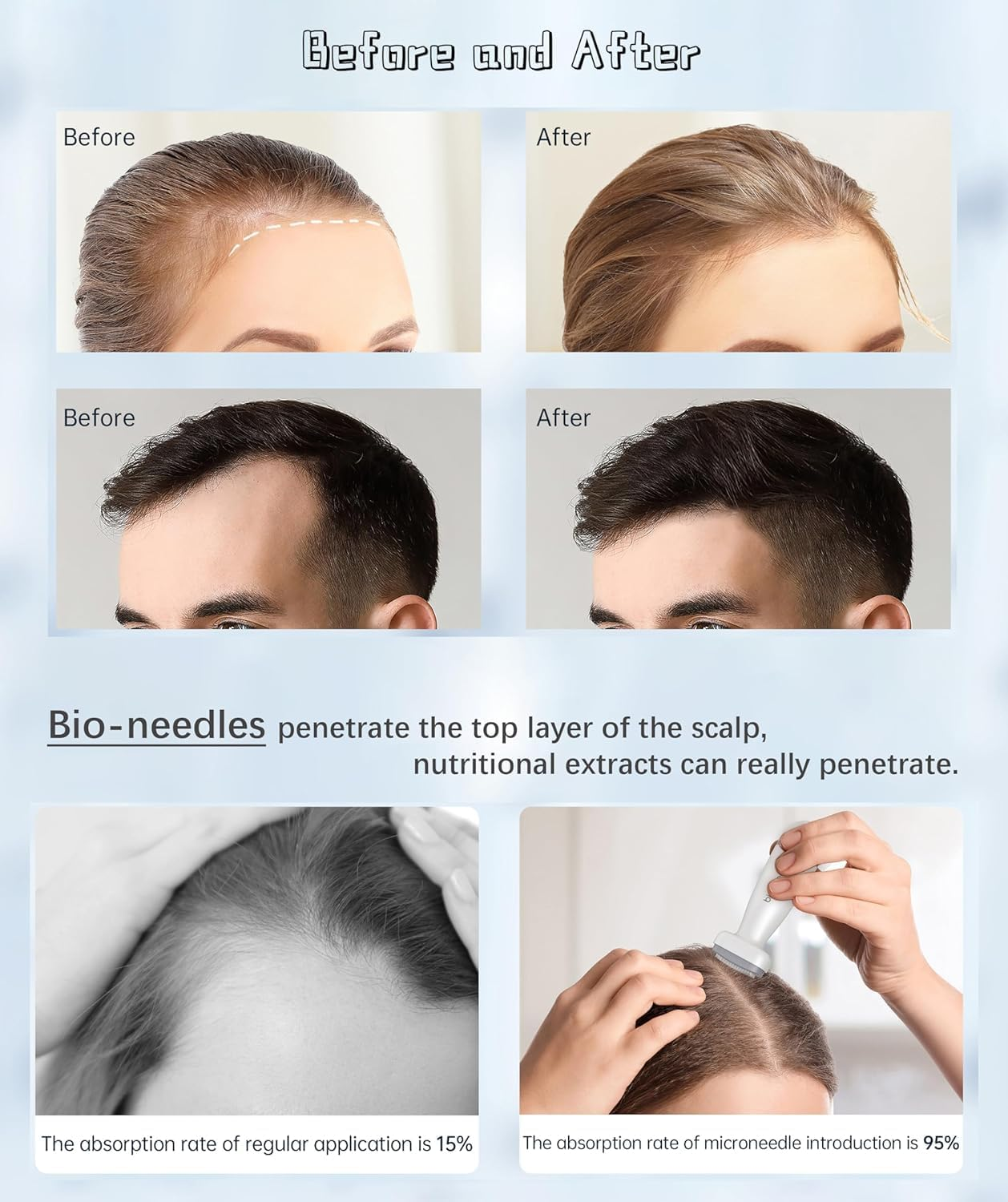 Dr.Pen Bioneedle 120 Titanium Adjustable Microneedling Derma Stamp - 2024 New Professional Derma Microneedle Pen - Amazing Skin Pen for Face Body Beard - Dr Beauty Pen for Men and Women Home Use