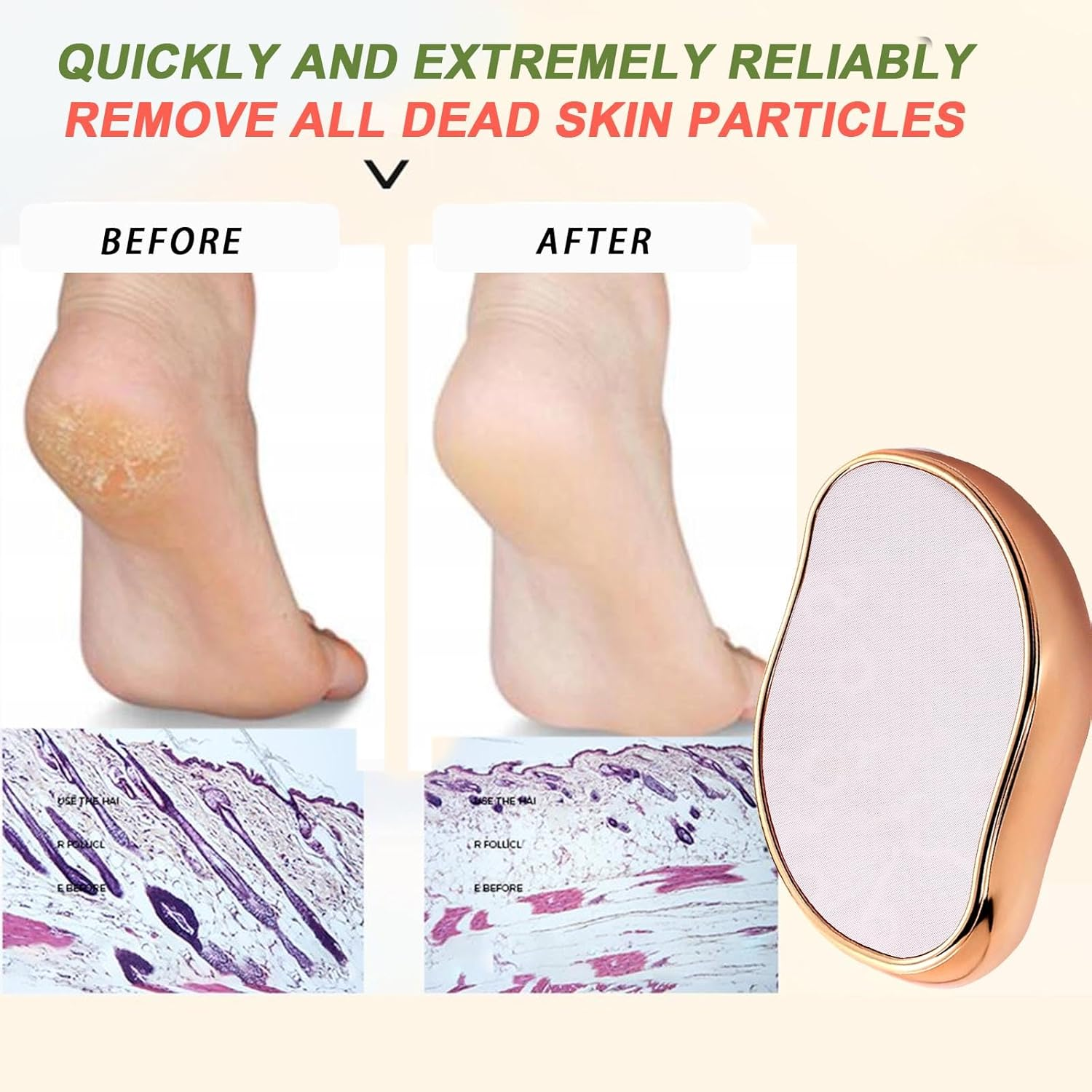 2-In-1 Nano Glass Callus Remover, Effective Nano Glass for Callus Removal on Wet and Dry Feet (With 1 Pack Foot Mask) image number 3